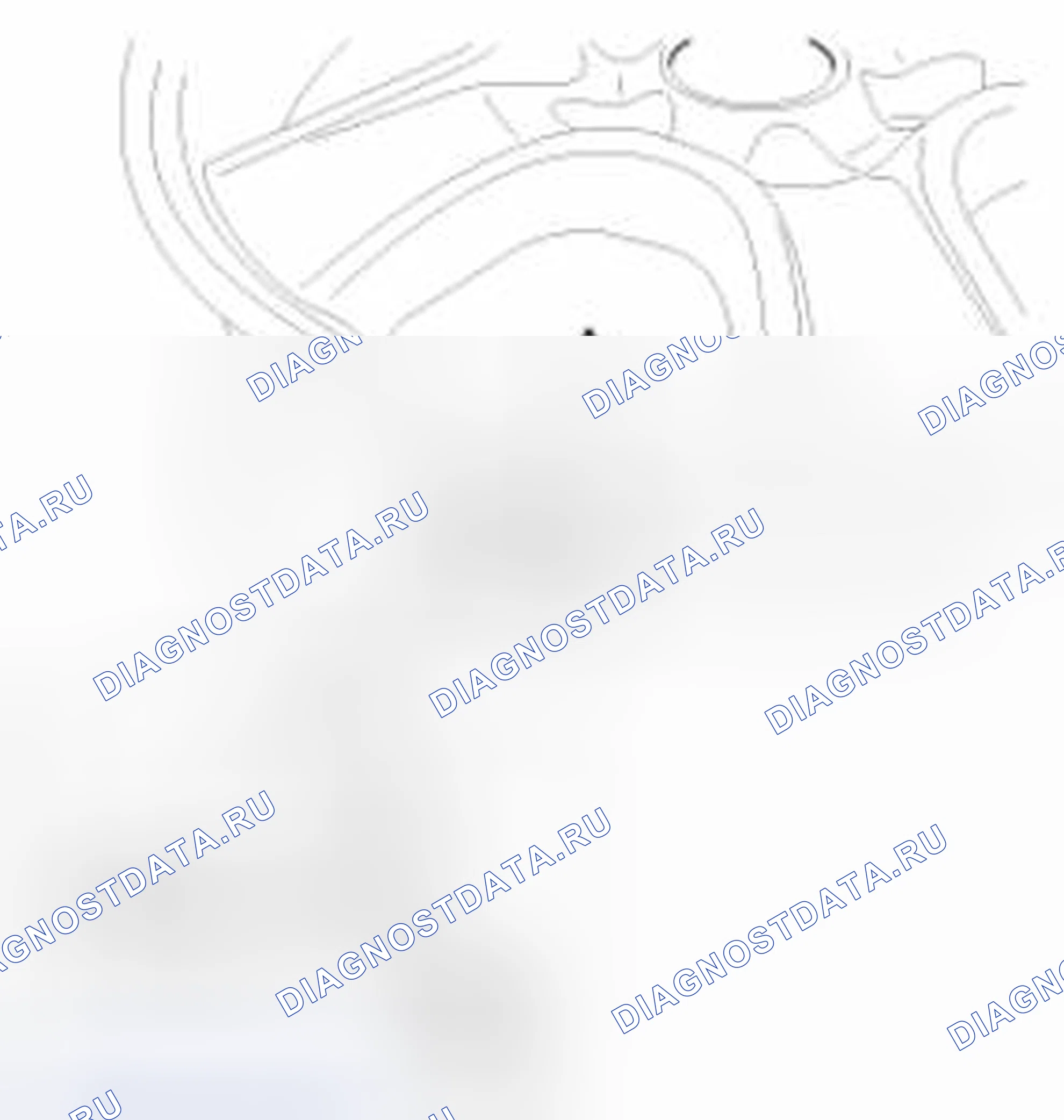 Рис. 26: При включении предупреждающей лампы TPMS. Geely Vision X3 Pro I