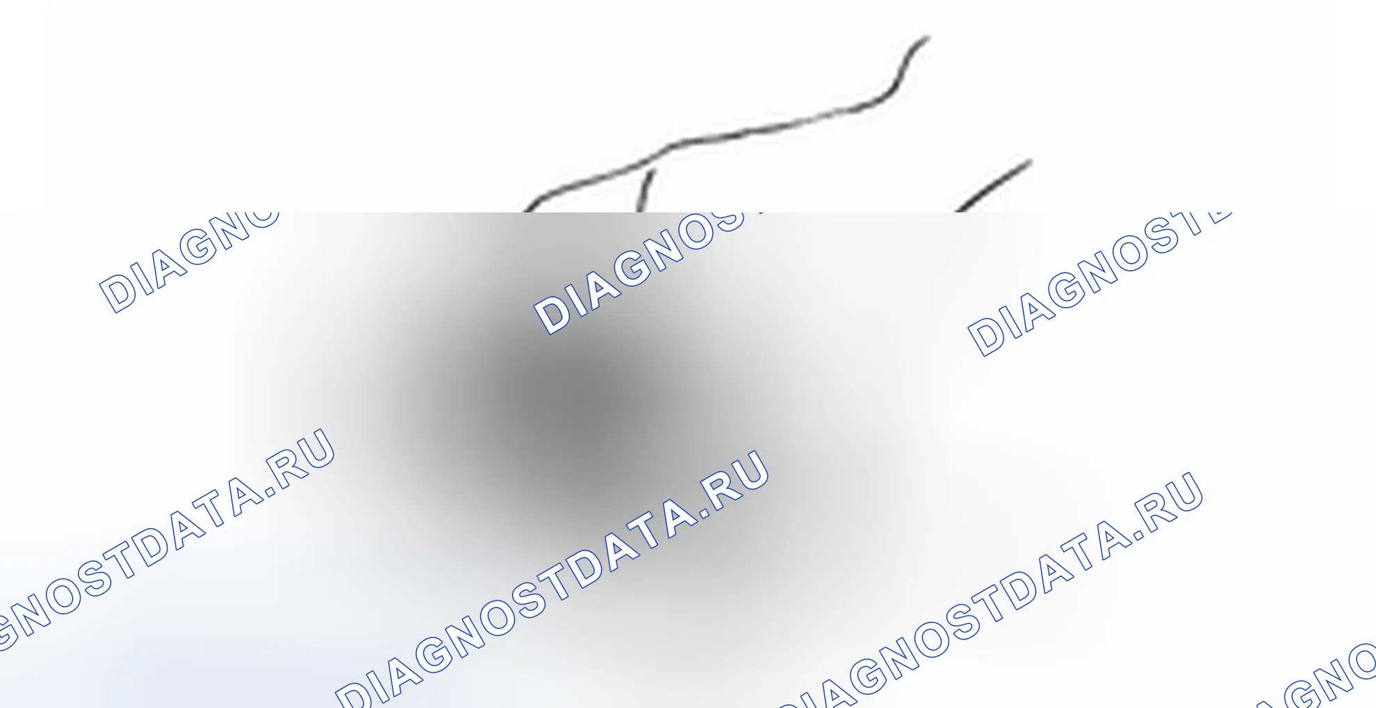Разборка дифференциала с ограниченным проскальзыванием (LSD). Hyundai H-1 A1