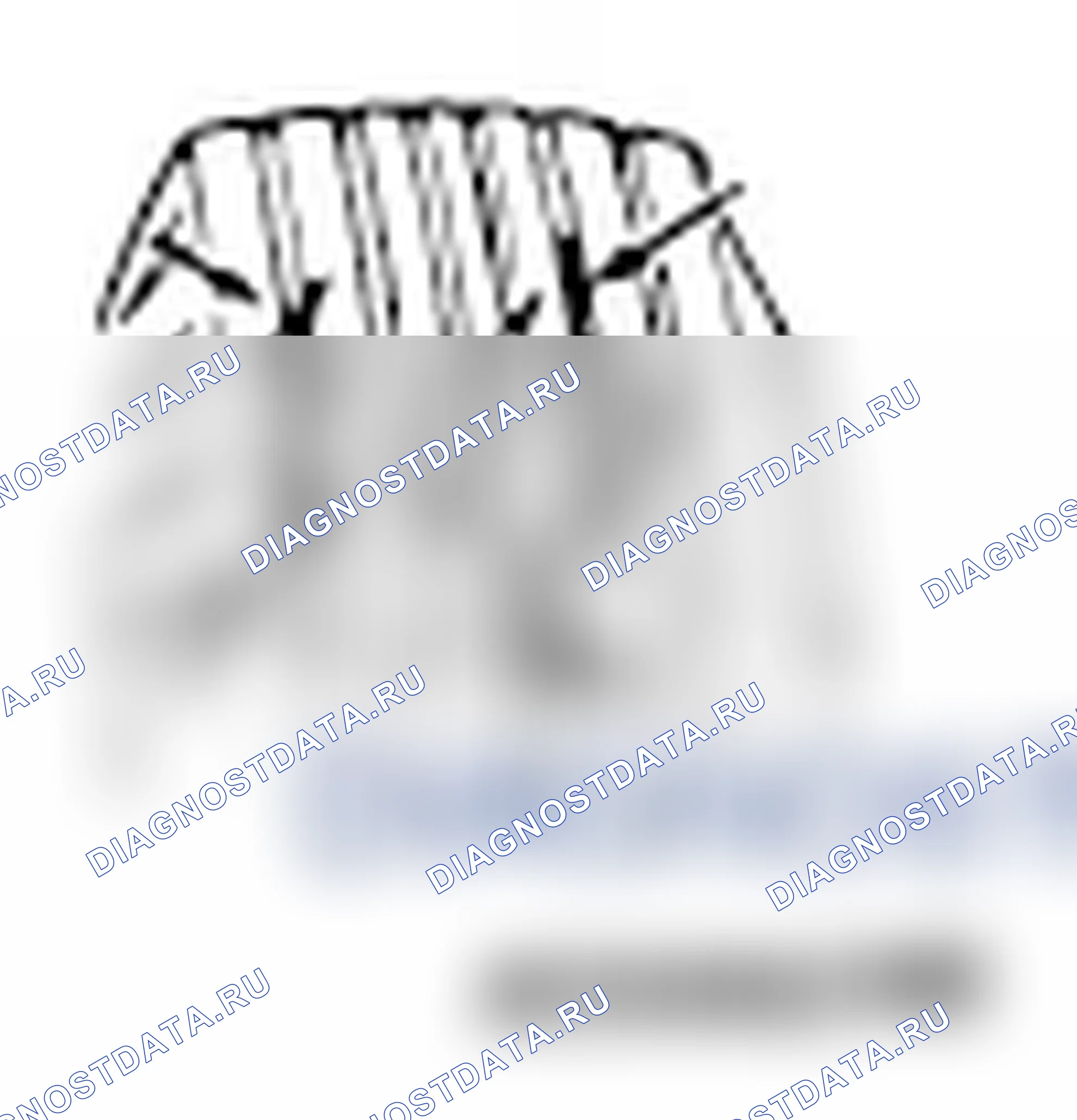 Рис. 4. Mitsubishi Lancer Ralliart X