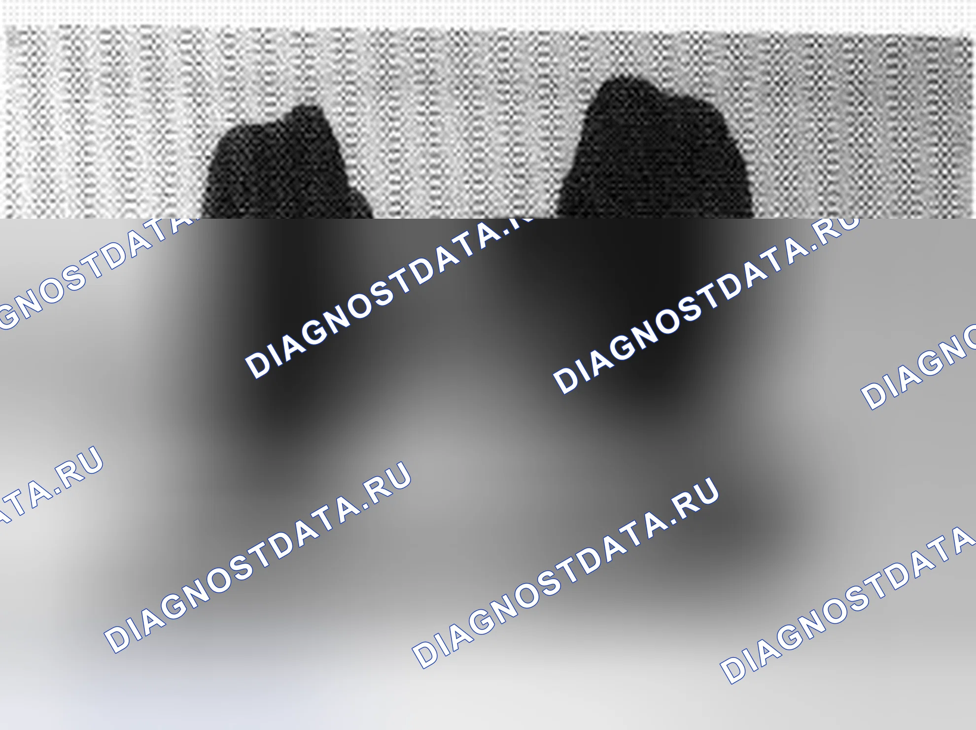 Рис. 242: Установка новой втулки. Volvo C70 I