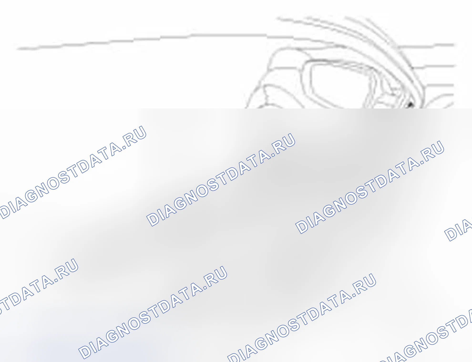 Рис. 33: Замена стекла. Hyundai Elantra V