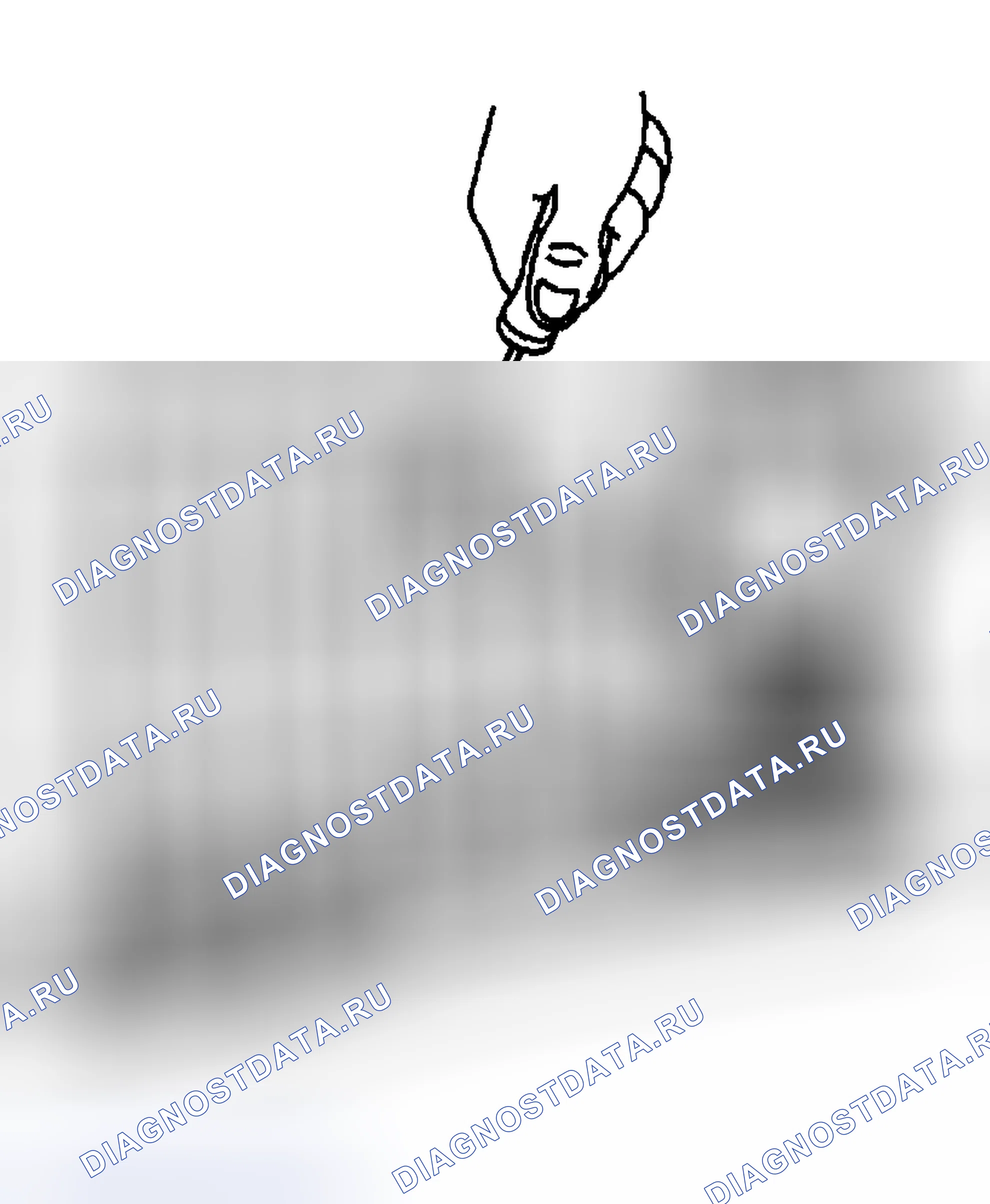 Рис. 267: Процедура установки. Hyundai Venue I