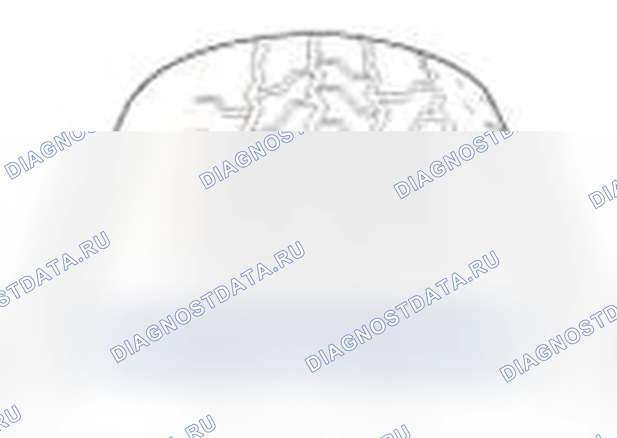 Рис. 46. Hyundai Elantra V