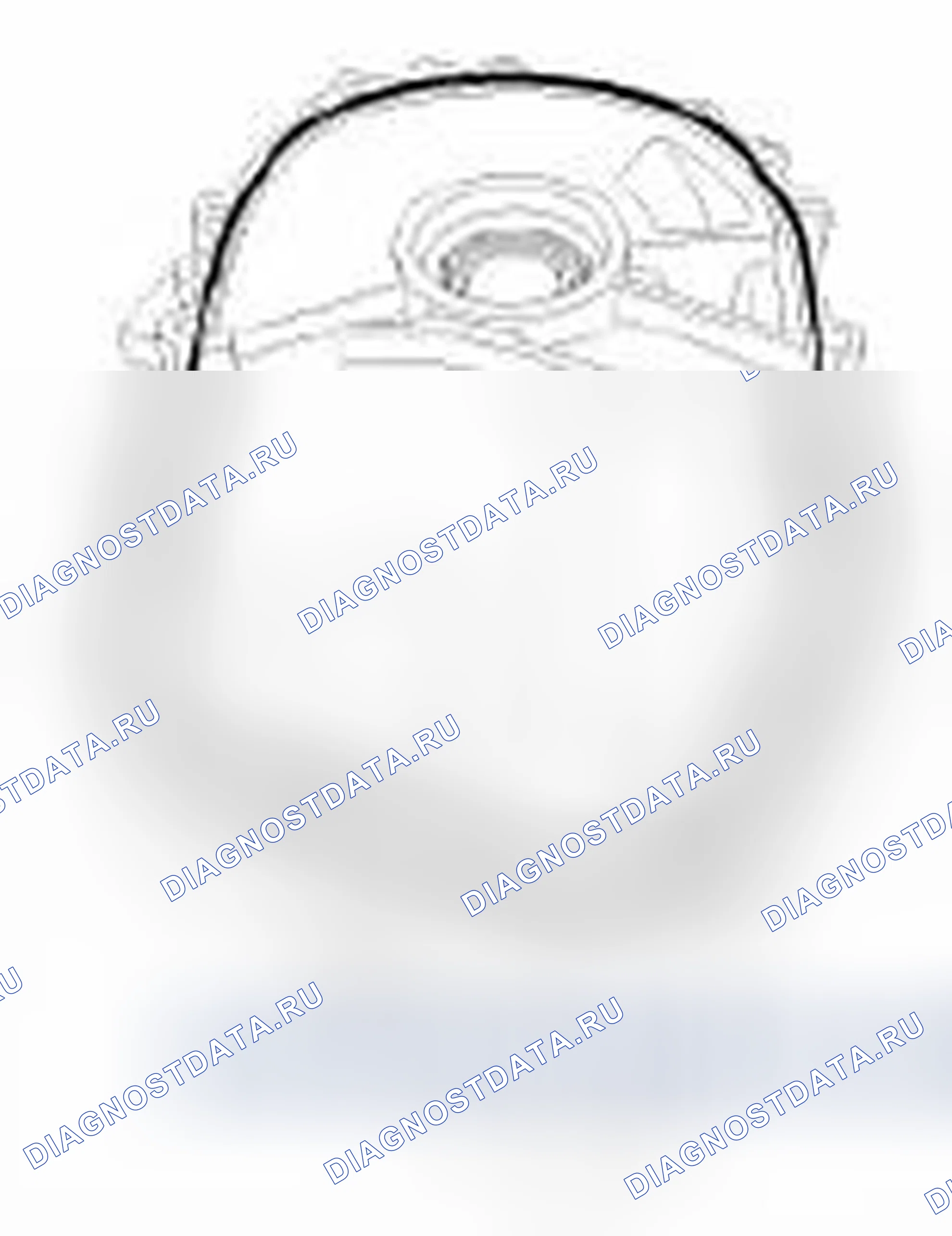 Рис. 81. Hyundai Accent III