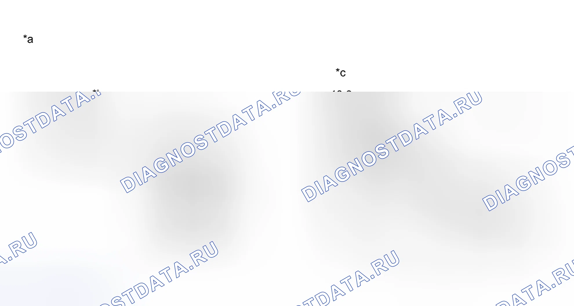Рис. 377: ПОРЯДОК ВЫПОЛНЕНИЯ РАБОТ. Toyota Avalon XX40