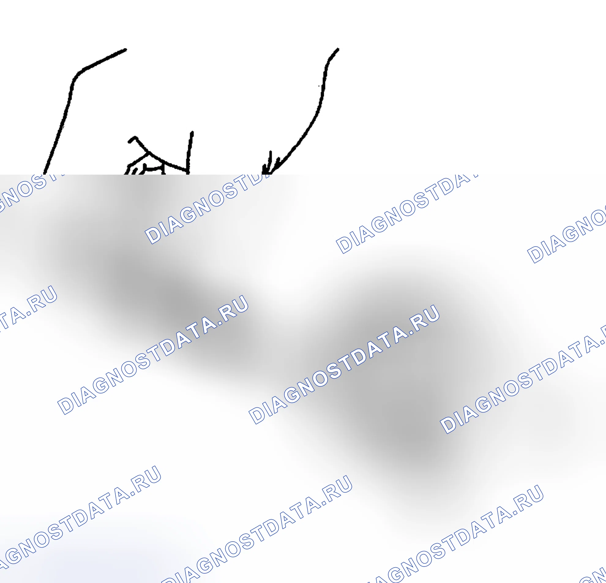 Рис. 23: Порядок демонтажа. Hyundai Venue I