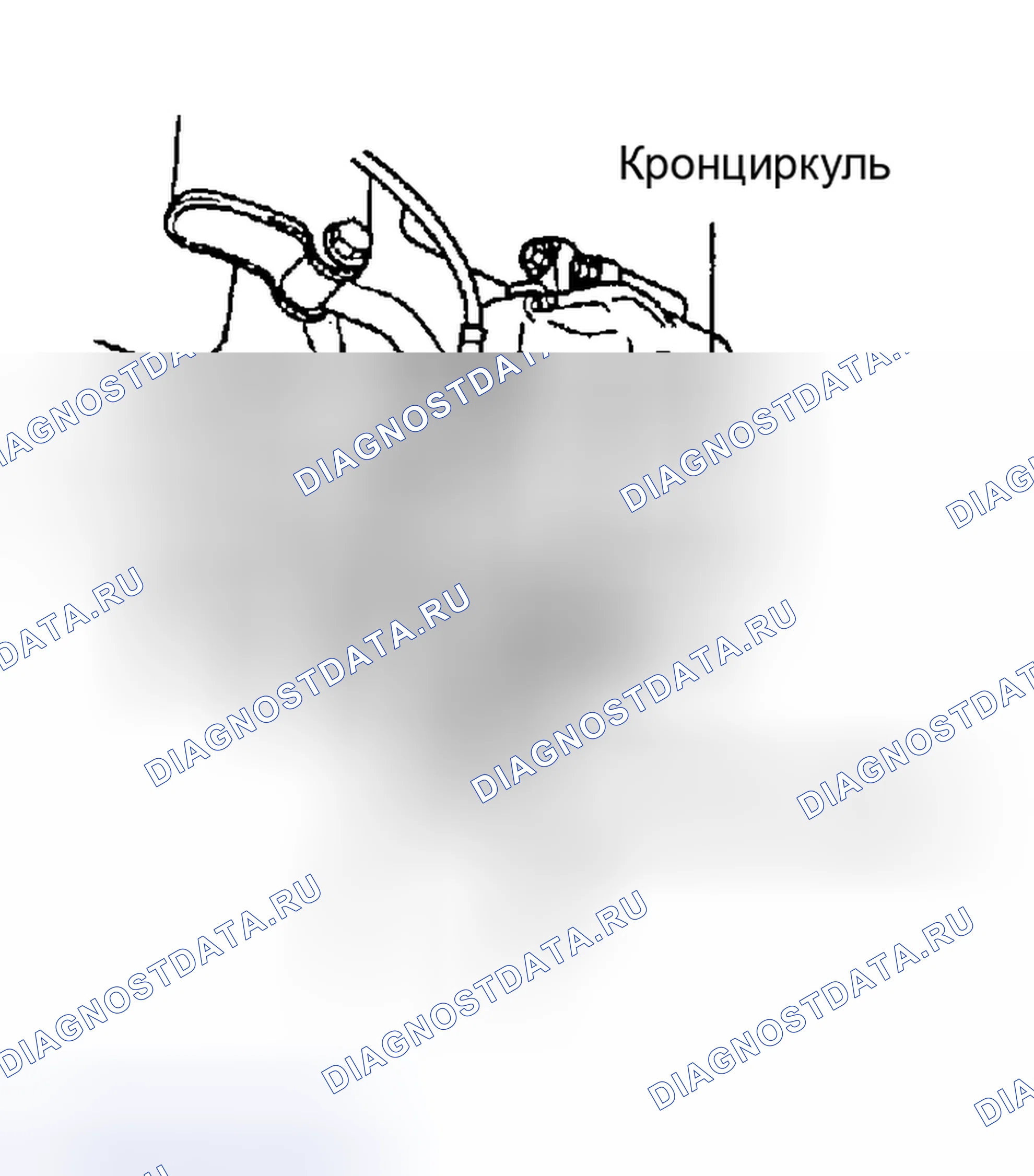 Рис. 6: ДЕМОНТАЖ. Kia Sedona I