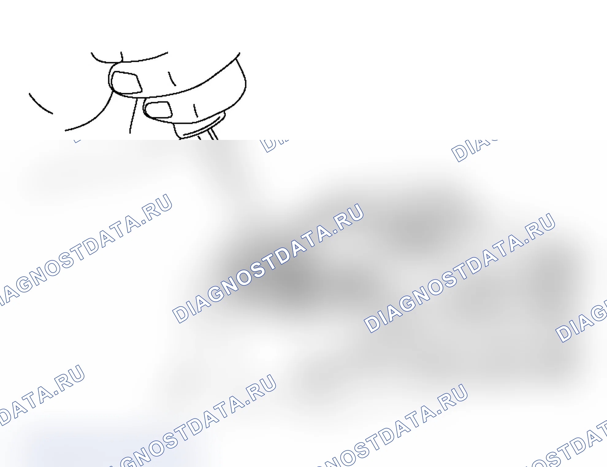Рис. 69: <<A>> СНЯТИЕ УПЛОТНИТЕЛЬНОЙ КРЫШКИ. Mitsubishi Lancer Ralliart IX рестайлинг