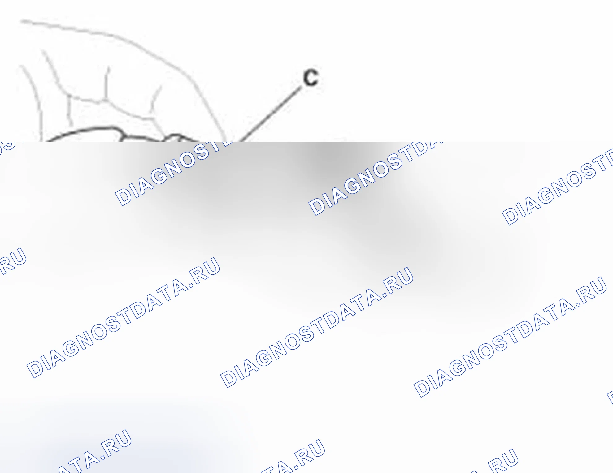 Рис. 35: Подключение. Hyundai Elantra V