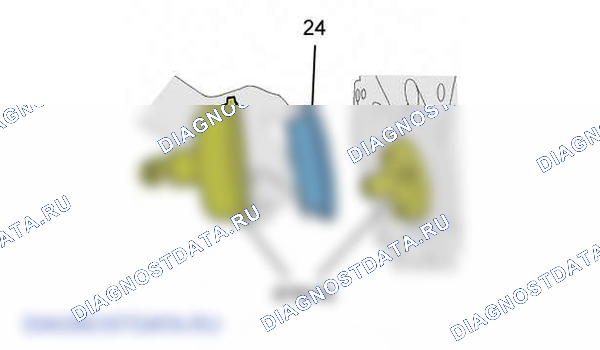 Повторная установка: двигателя — b1bg31zd. Citroen C5 I рестайлинг