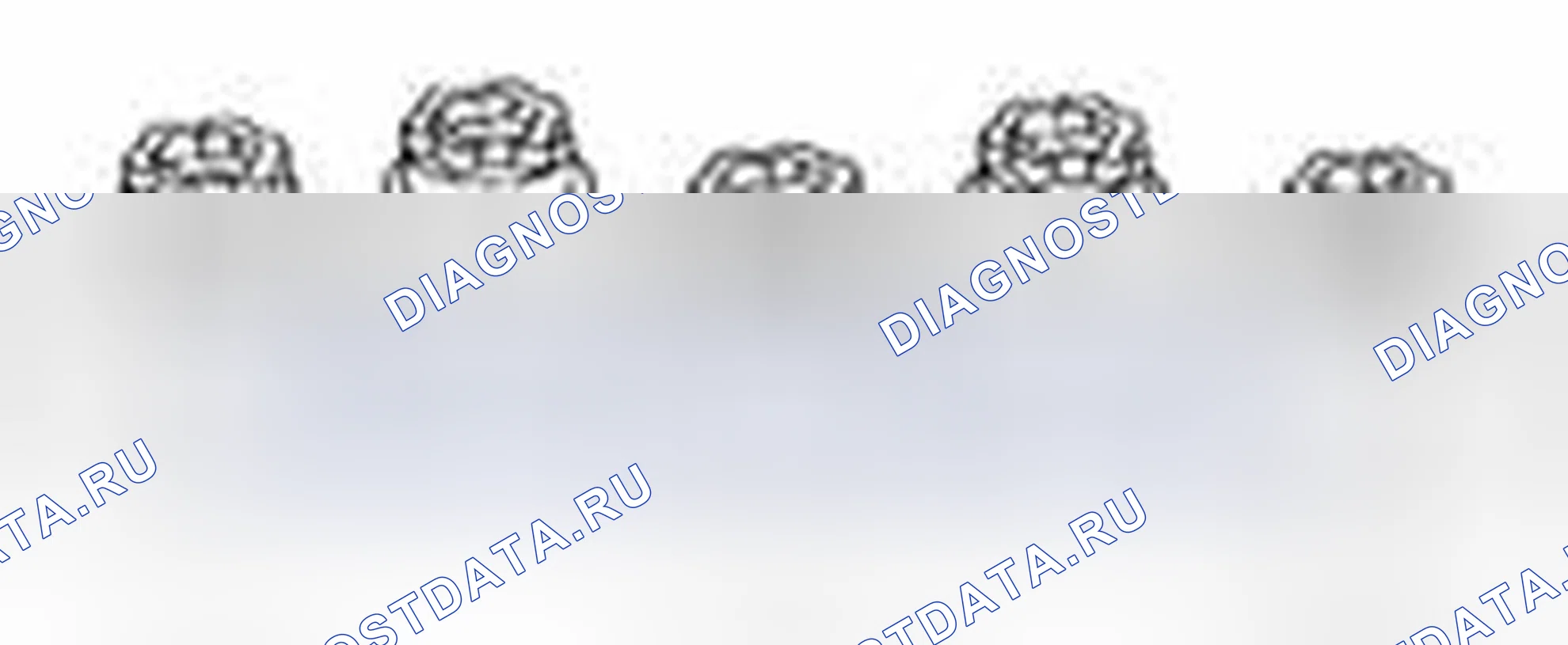 Рис. 168: Специальный сервисный инструмент (подушка безопасности). Suzuki Equator I