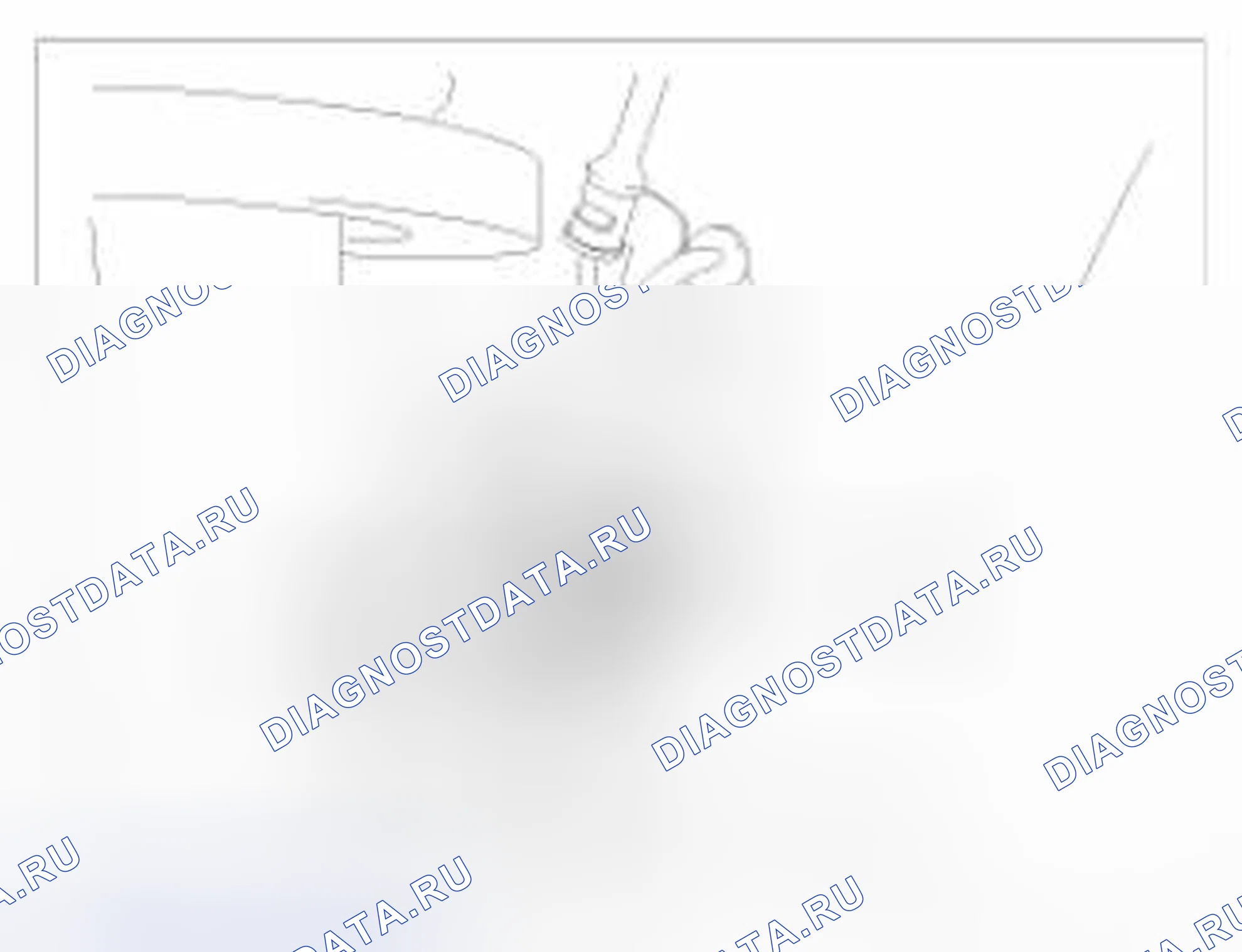 Рис. 99: Удаление. BMW 6 серия F06/F13/F12