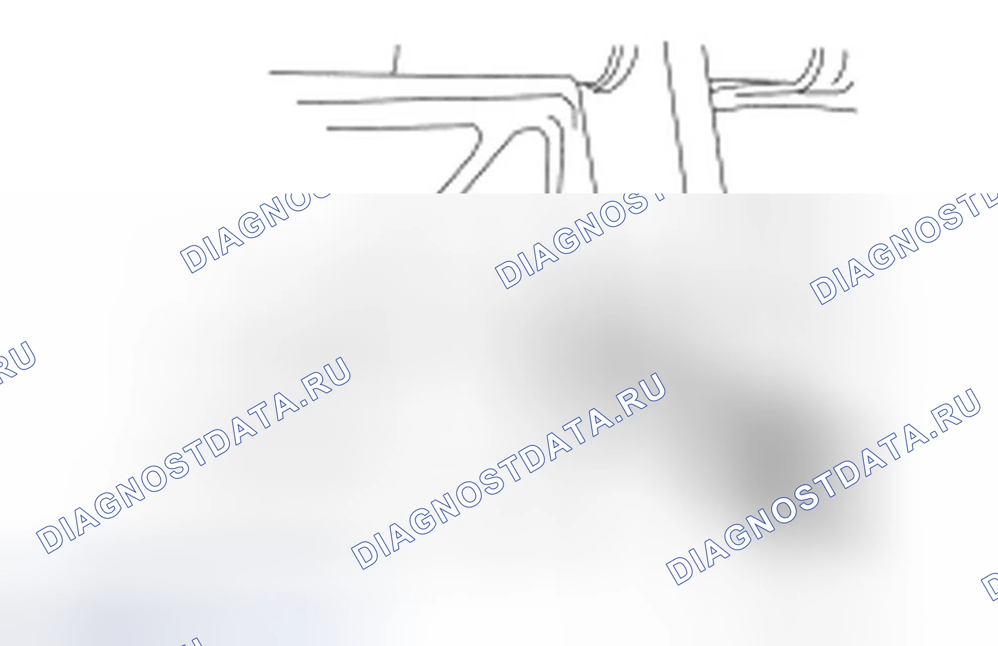 Рис. 5: ДЕМОНТАЖ. Ford Ranger II