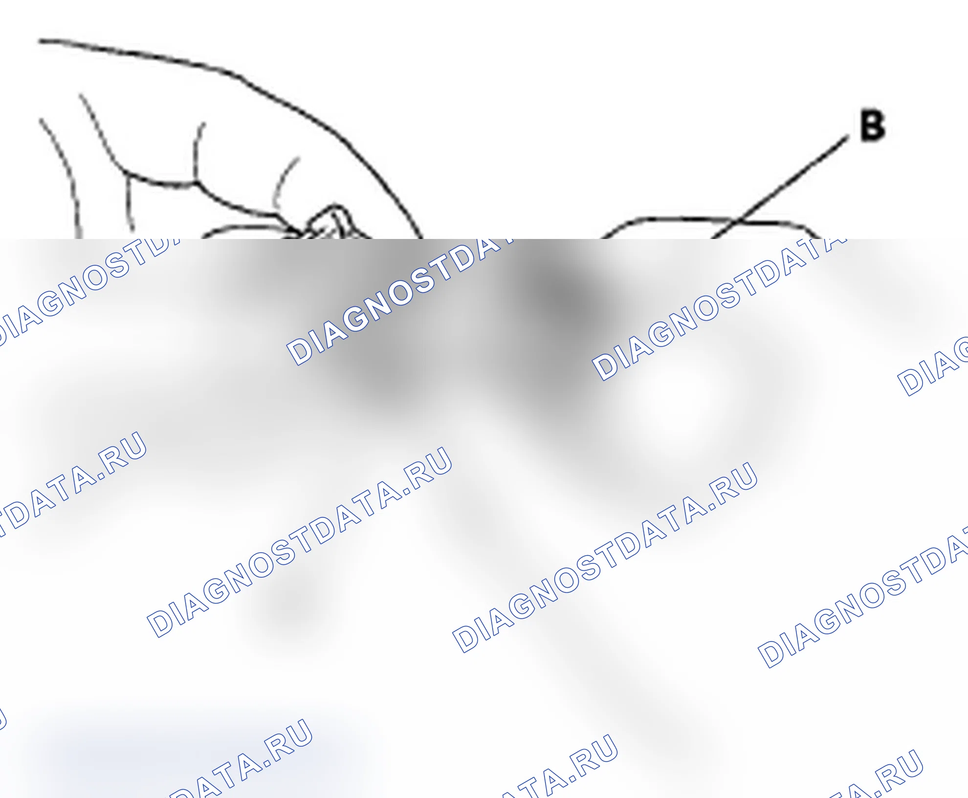 Рис. 17: Разъединение. Acura RDX I