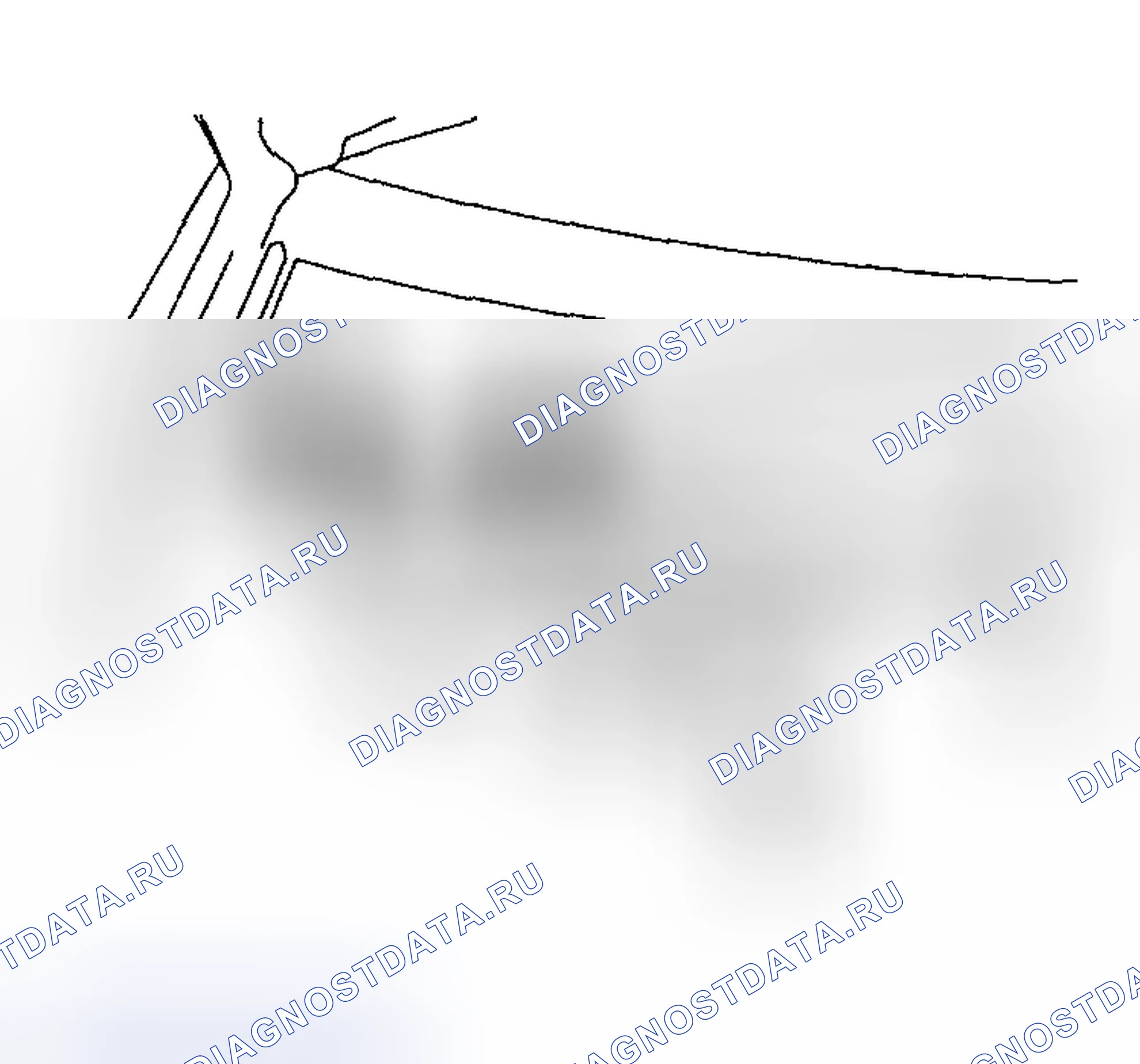 Рис. 93: ДЕМОНТАЖ. Subaru Impreza GD/GC/GG рестайлинг