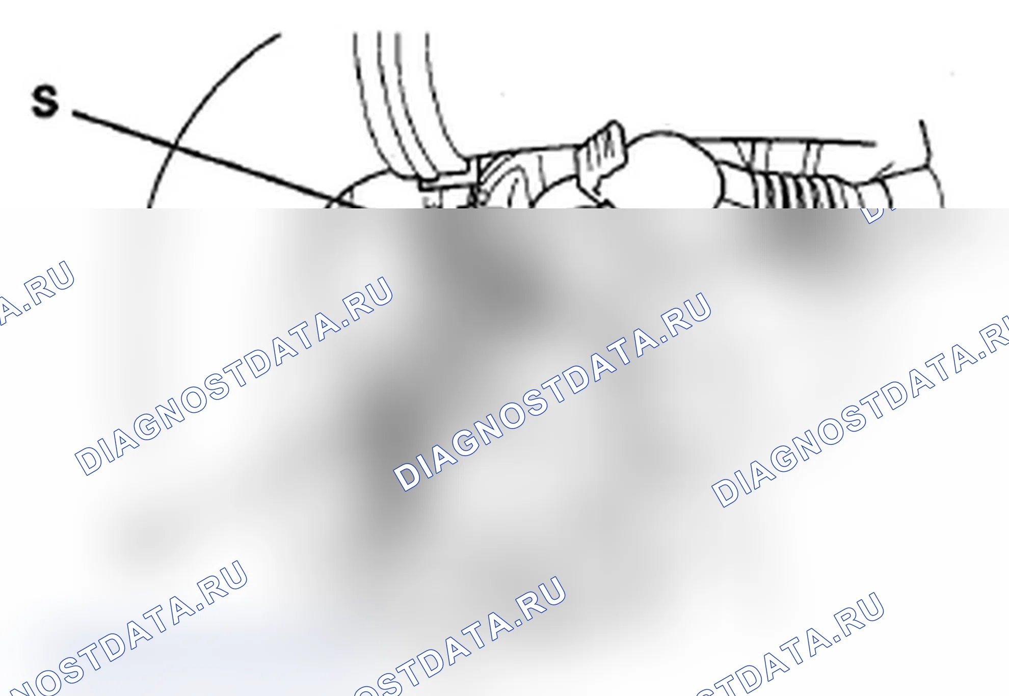 Рис. 4. Acura MDX II рестайлинг