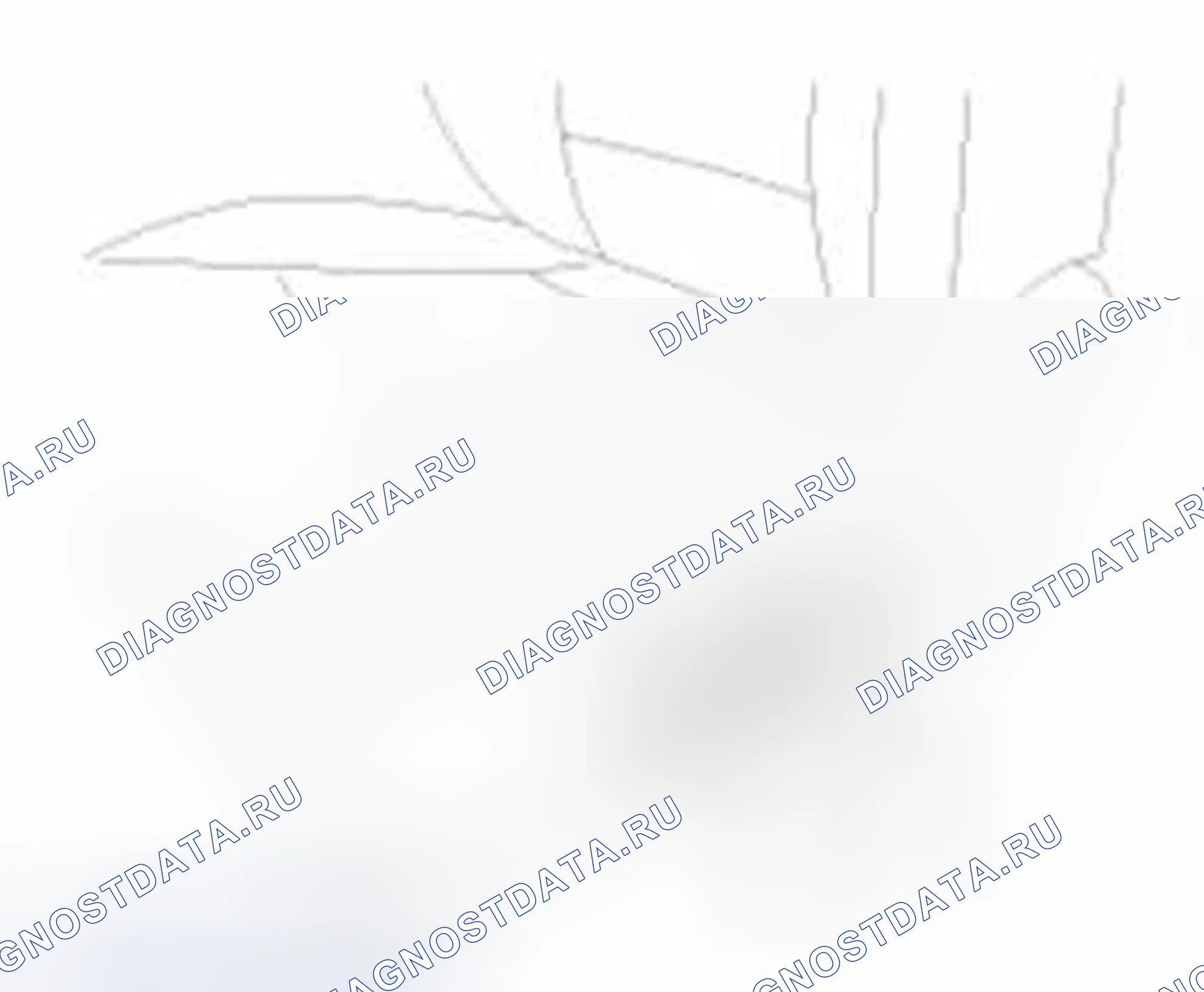 Рис. 5: Замена крышки реклайнера. Hyundai Sonata VI