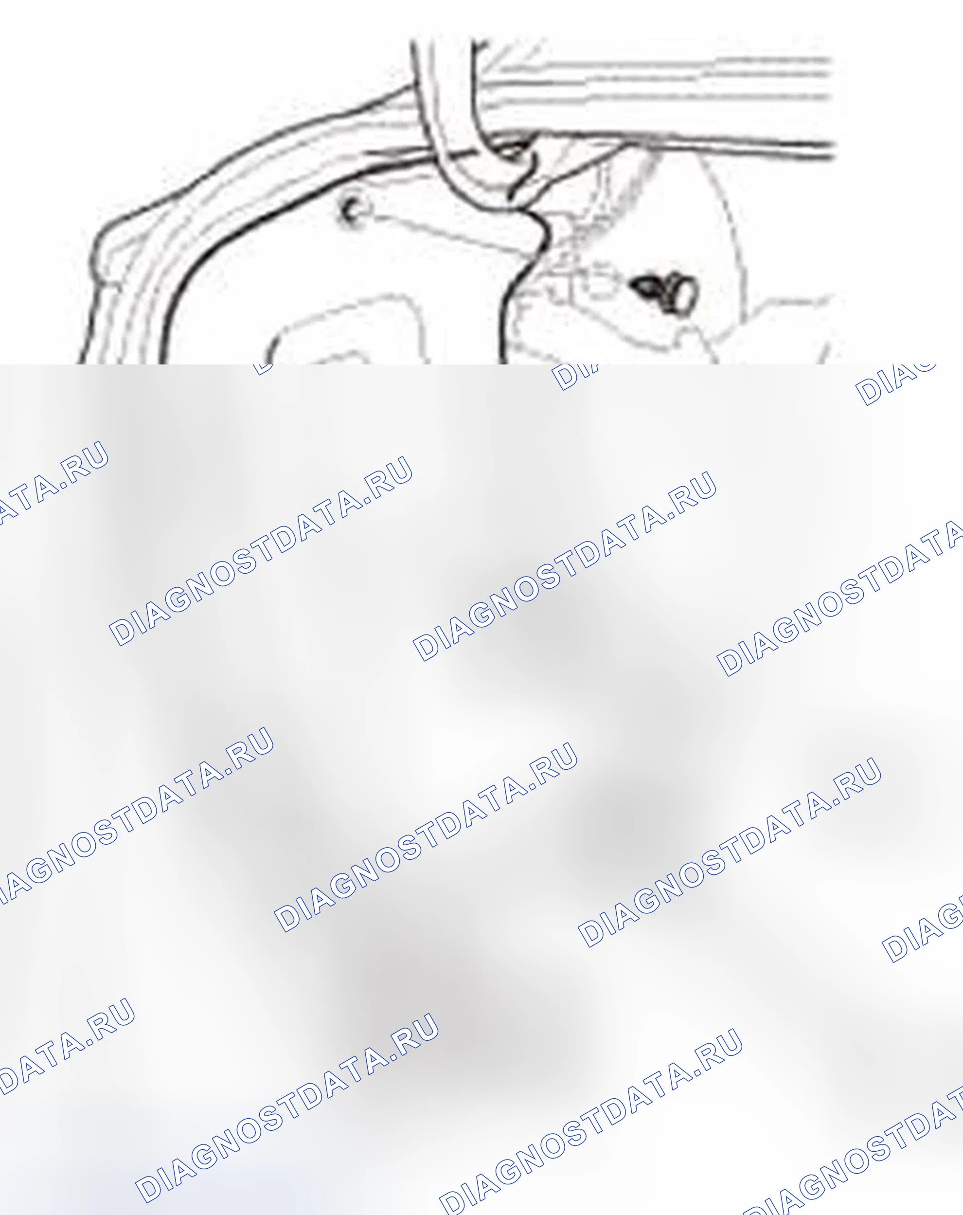 Рис. 926. Honda Civic IX