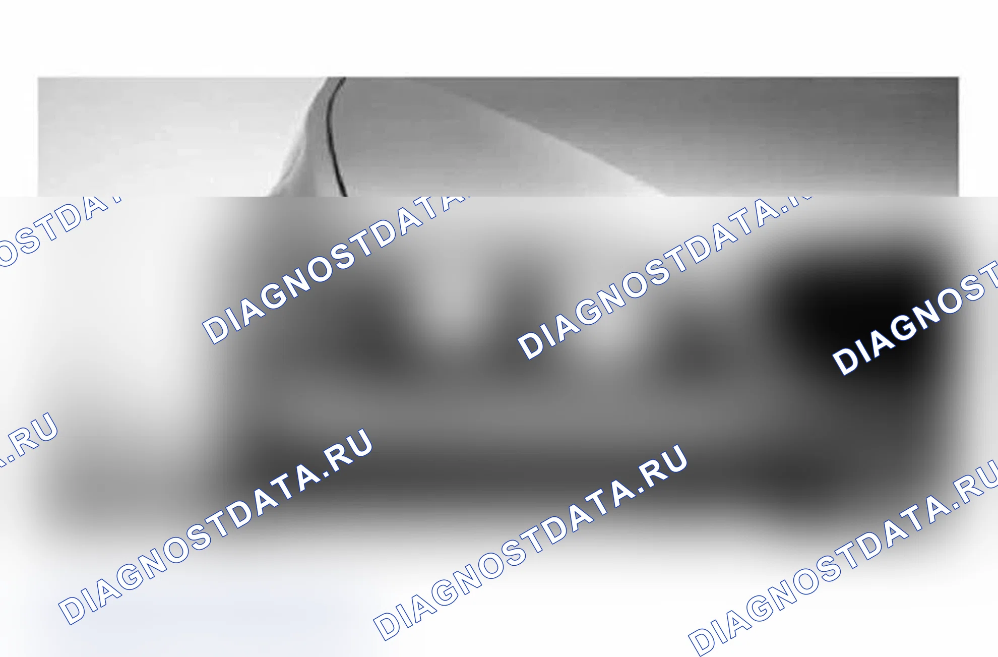 Рис. 287: Датчик дождя/света (RLS). BMW M3 E46