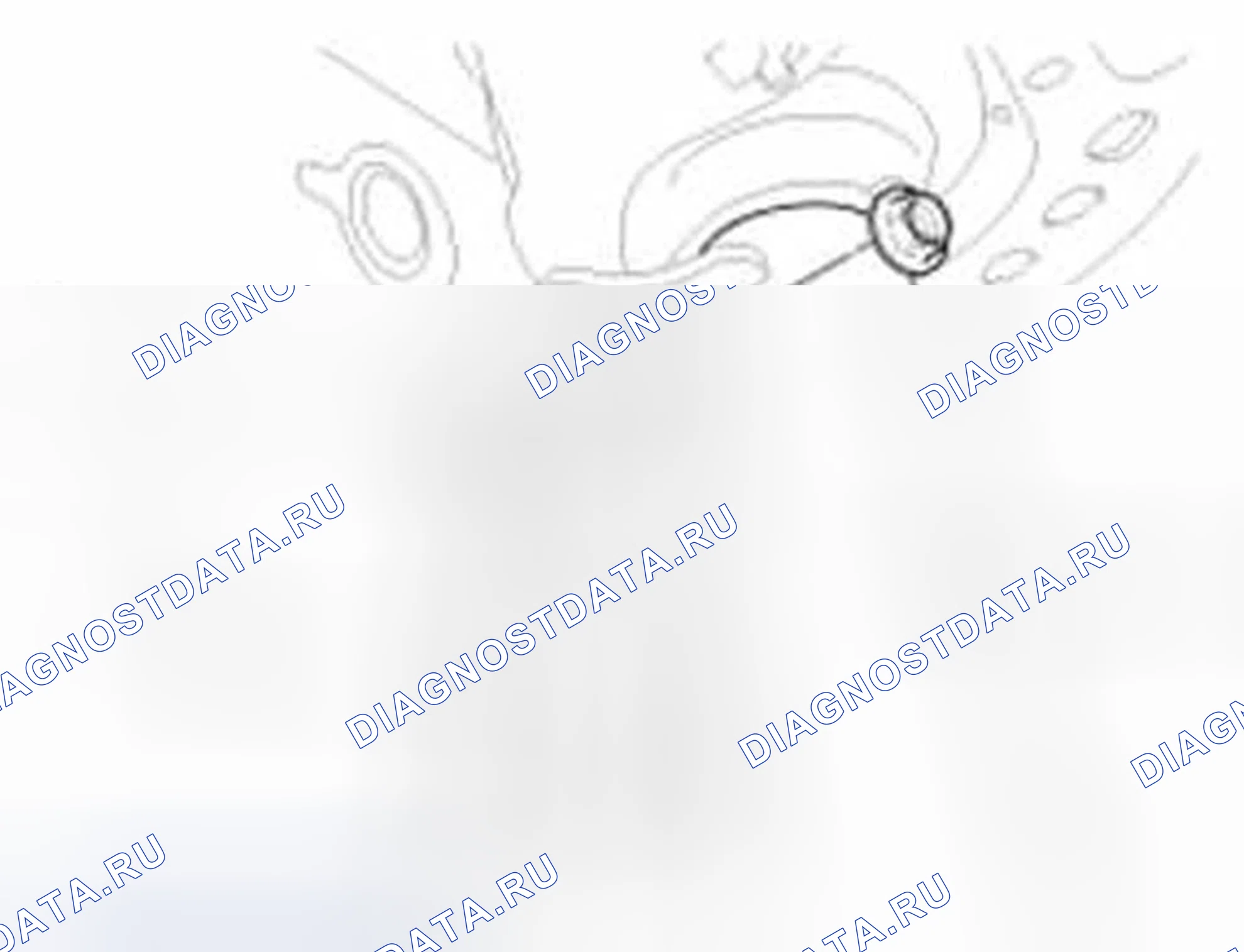 Рис. 67: Замена. Hyundai Sonata VI