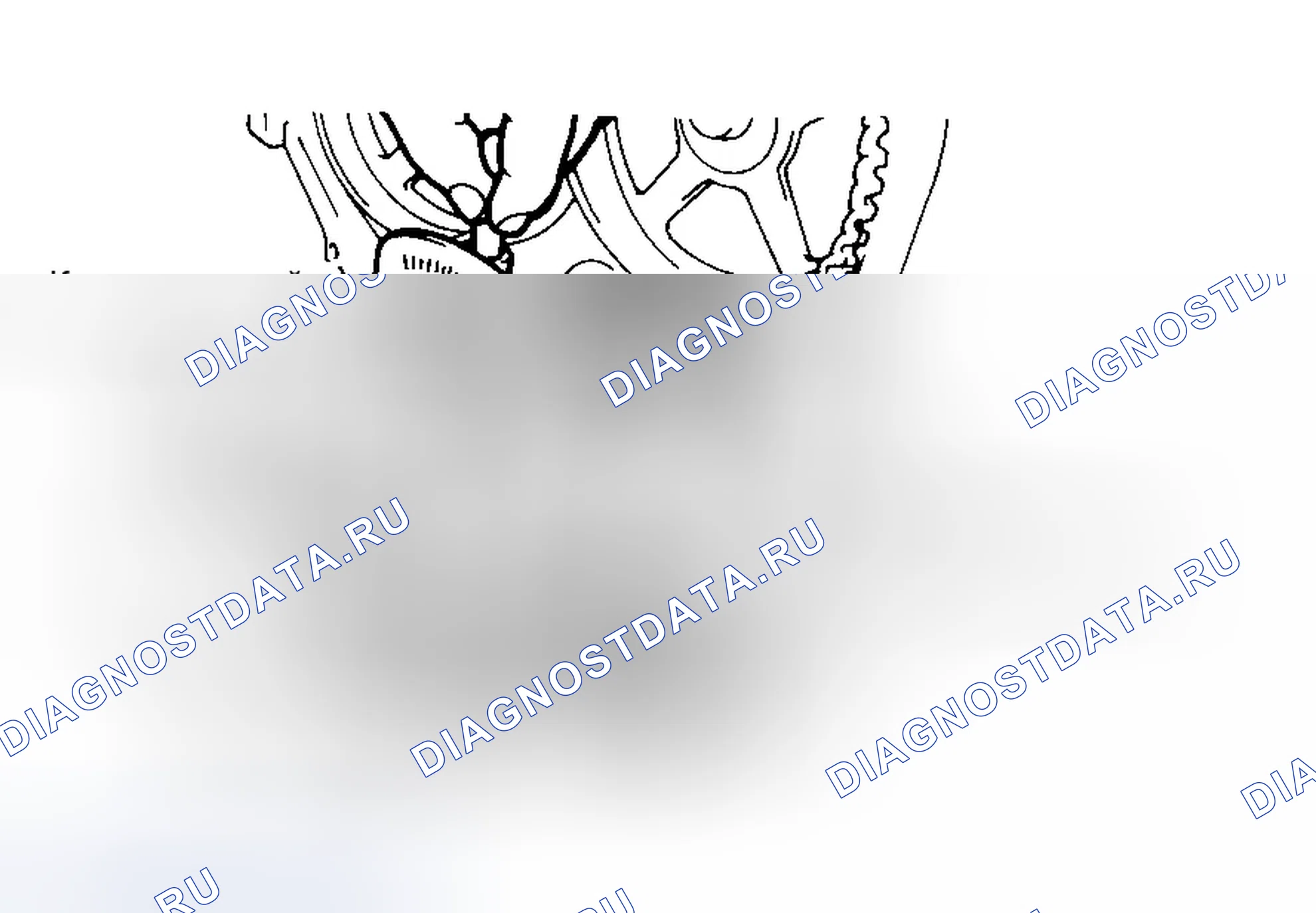 Рис. 12. Eagle Talon I