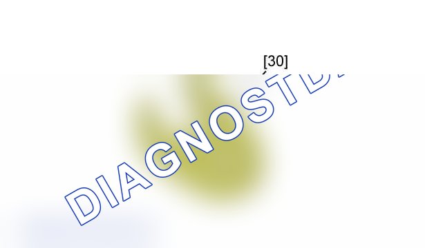Повторная установка: двигателя DW12TED4 - DW12UTED — e5am0qqd. Peugeot 607 I рестайлинг