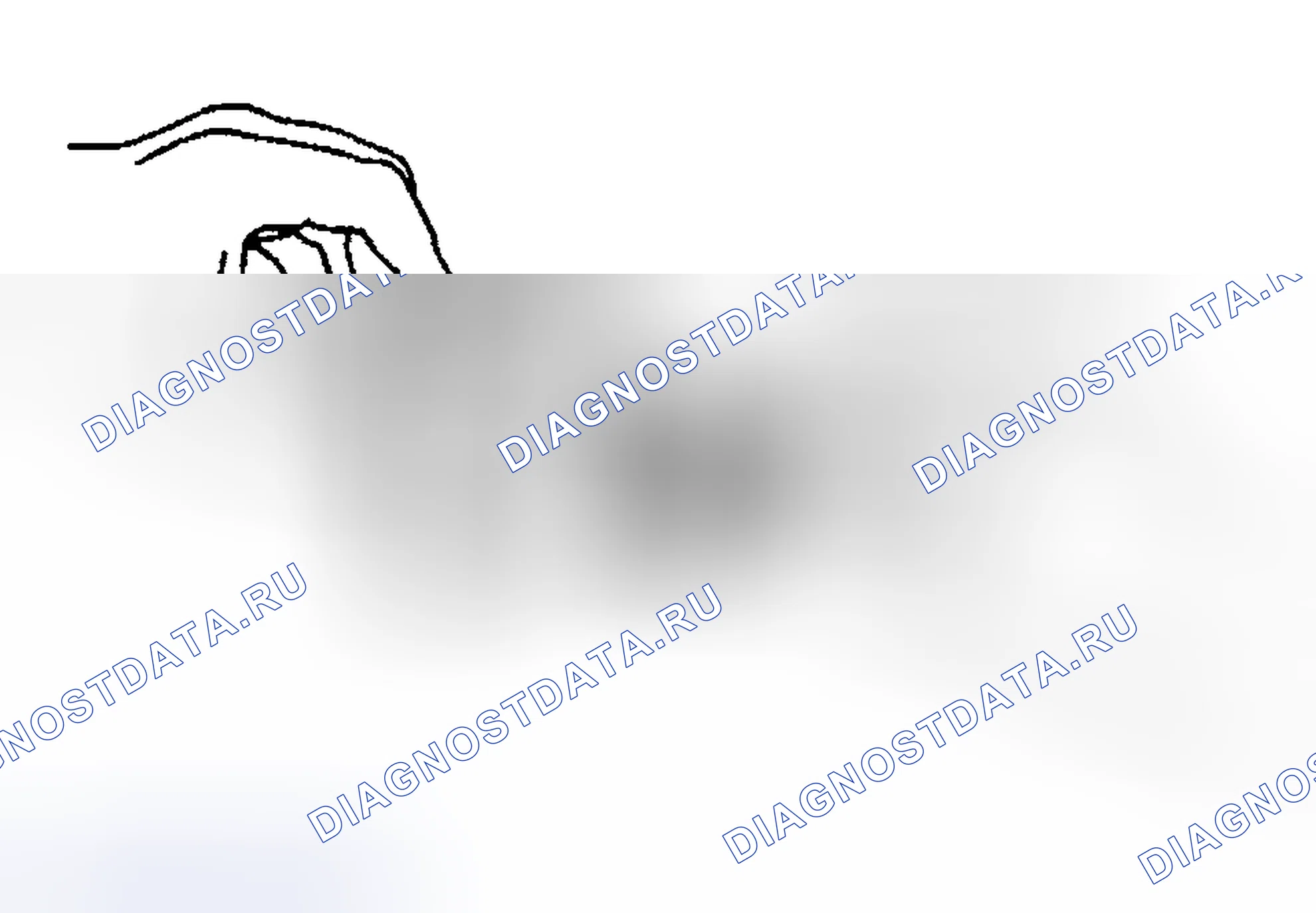 Рис. 247: Процедура установки. Hyundai Venue I