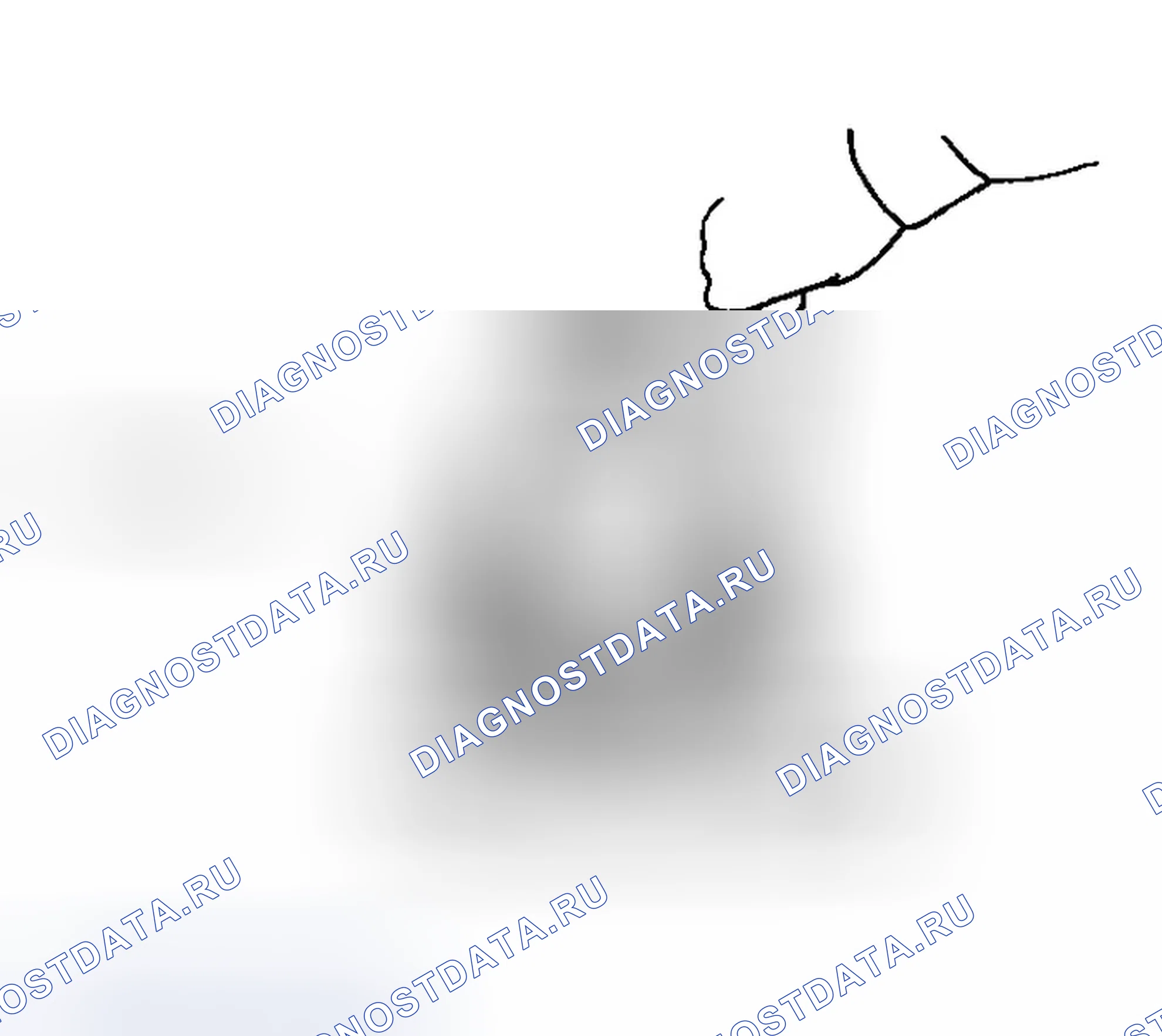 Рис. 305: СБОРКА КАРТЕРА ДИФФЕРЕНЦИАЛА (R200V). Infiniti G35 III