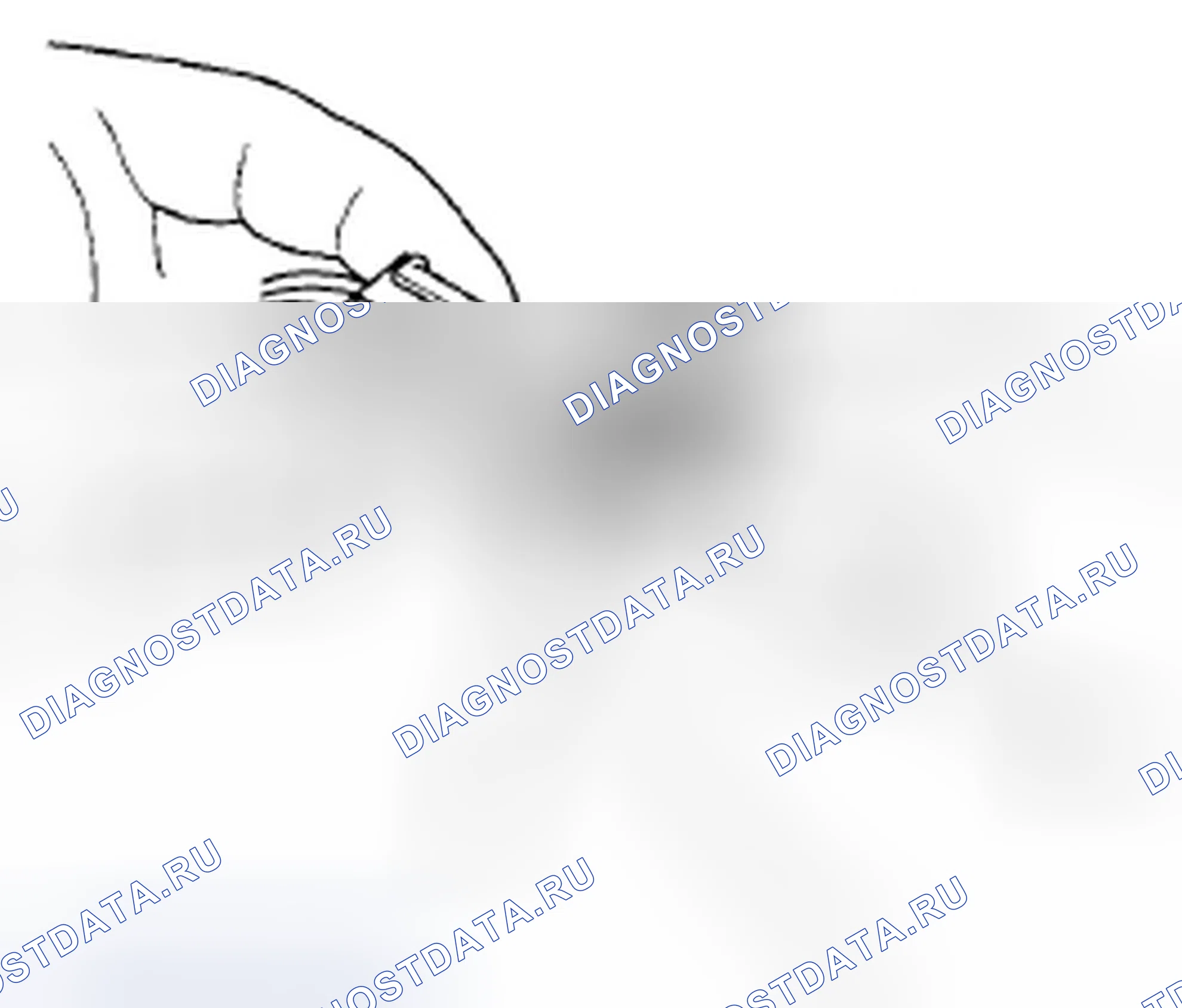 Рис. 268: Разъединение. Honda Civic VIII рестайлинг