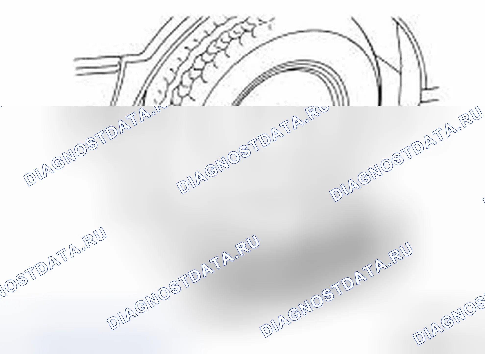 Рис. 63: УГОЛ ПОВОРОТА ПЕРЕДНЕГО КОЛЕСА. Infiniti QX56 II