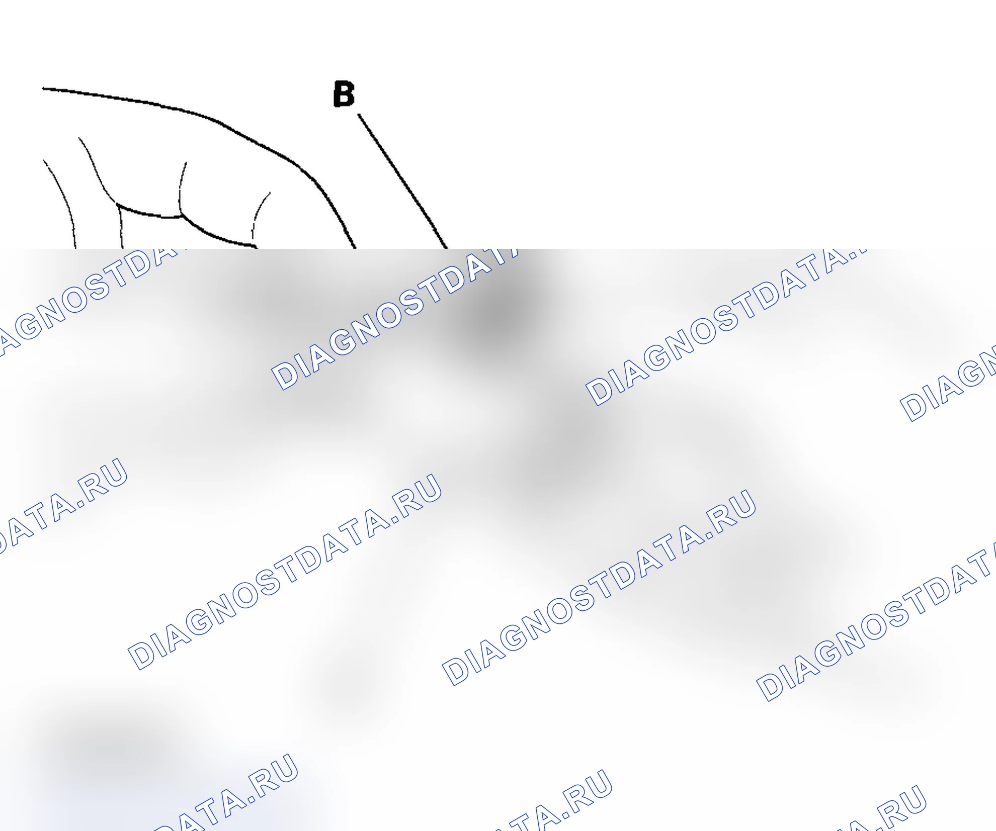 Рис. 21: Разъединение. Acura TL III
