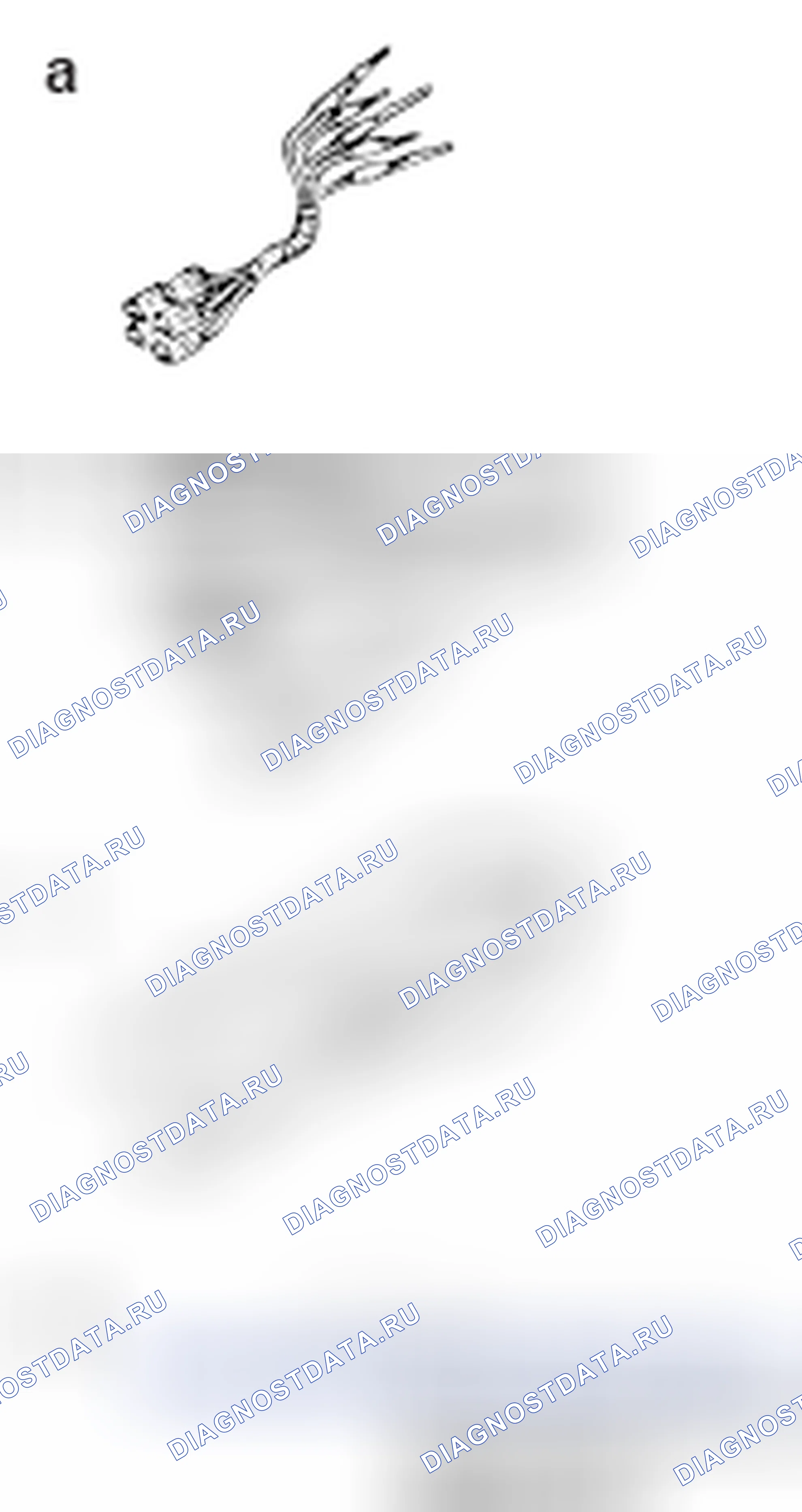 Рис. 117. Mitsubishi Lancer Ralliart X рестайлинг