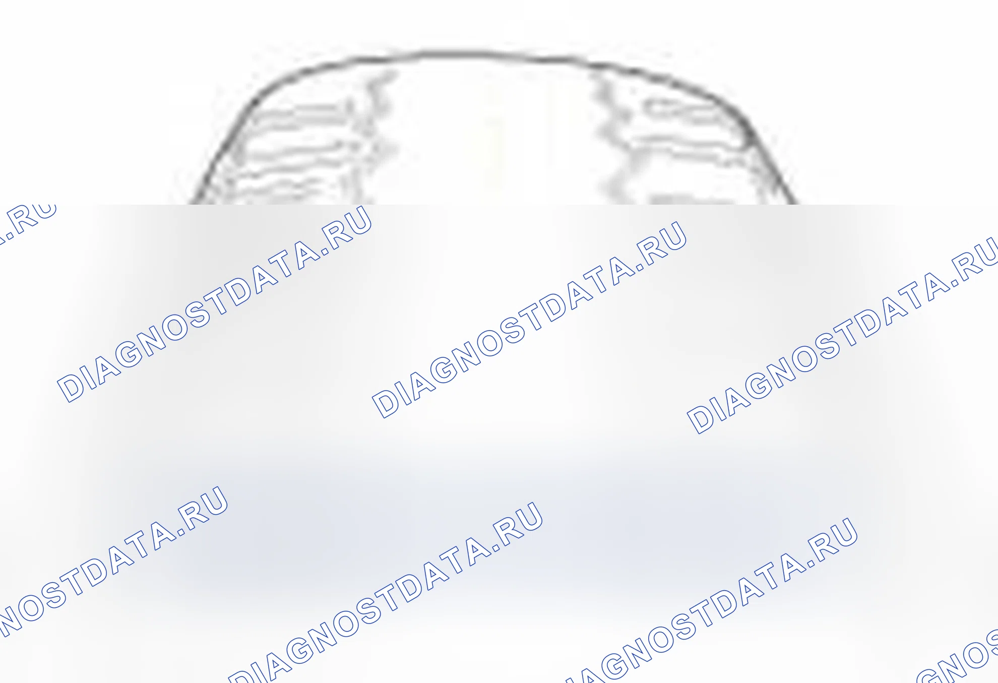 Рис. 44. Hyundai Elantra V