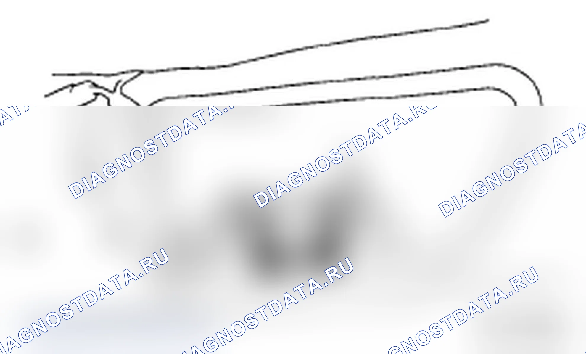 Рис. 22: ДЕМОНТАЖ. Subaru Impreza WRX GD/GG рестайлинг 2
