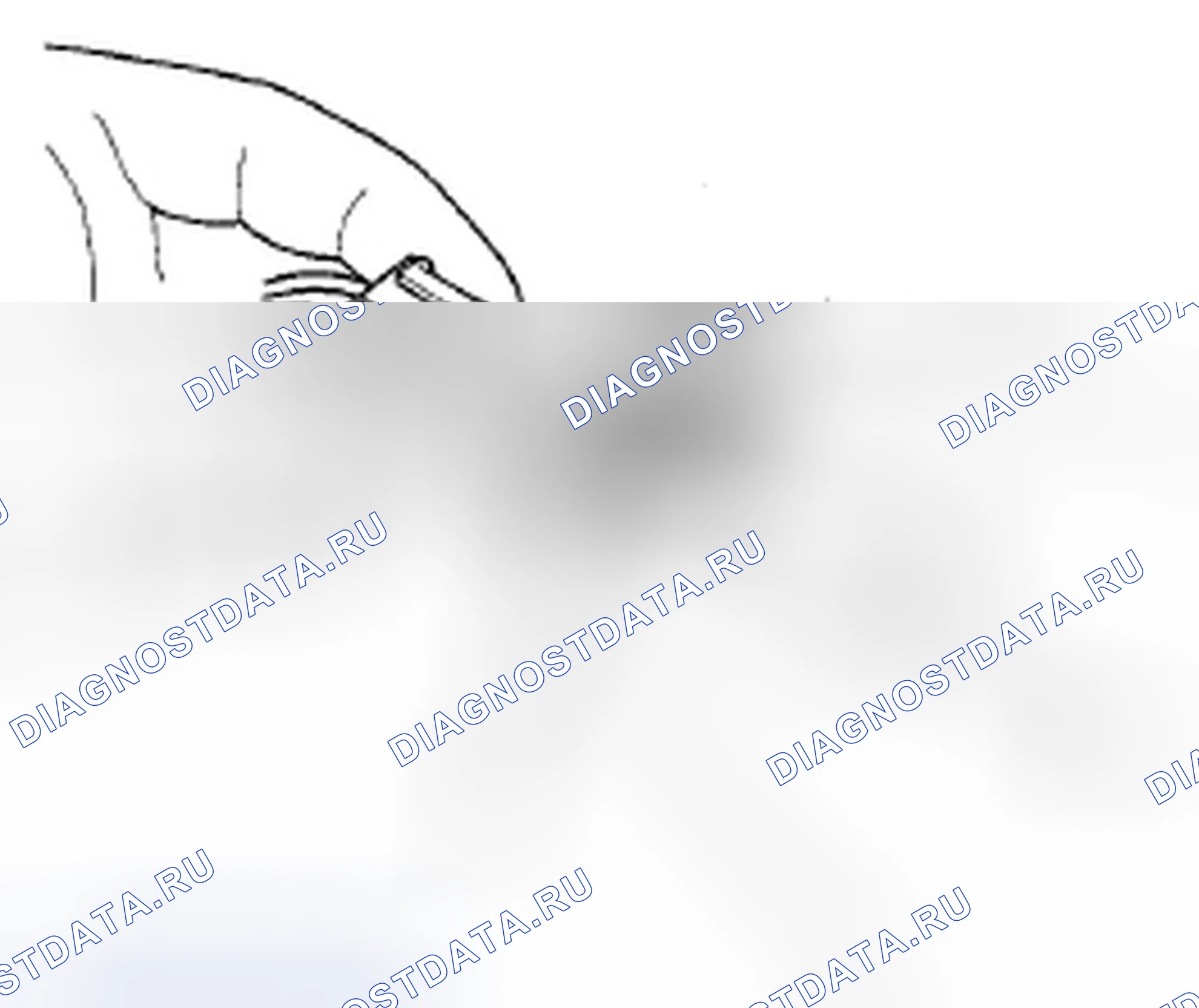 Рис. 239: Разъединение. Acura ZDX I