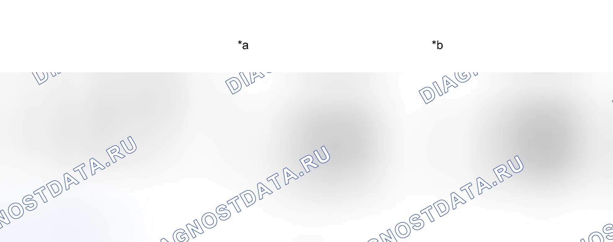 Рис. 232: ПОРЯДОК ВЫПОЛНЕНИЯ РАБОТ. Lexus CT I