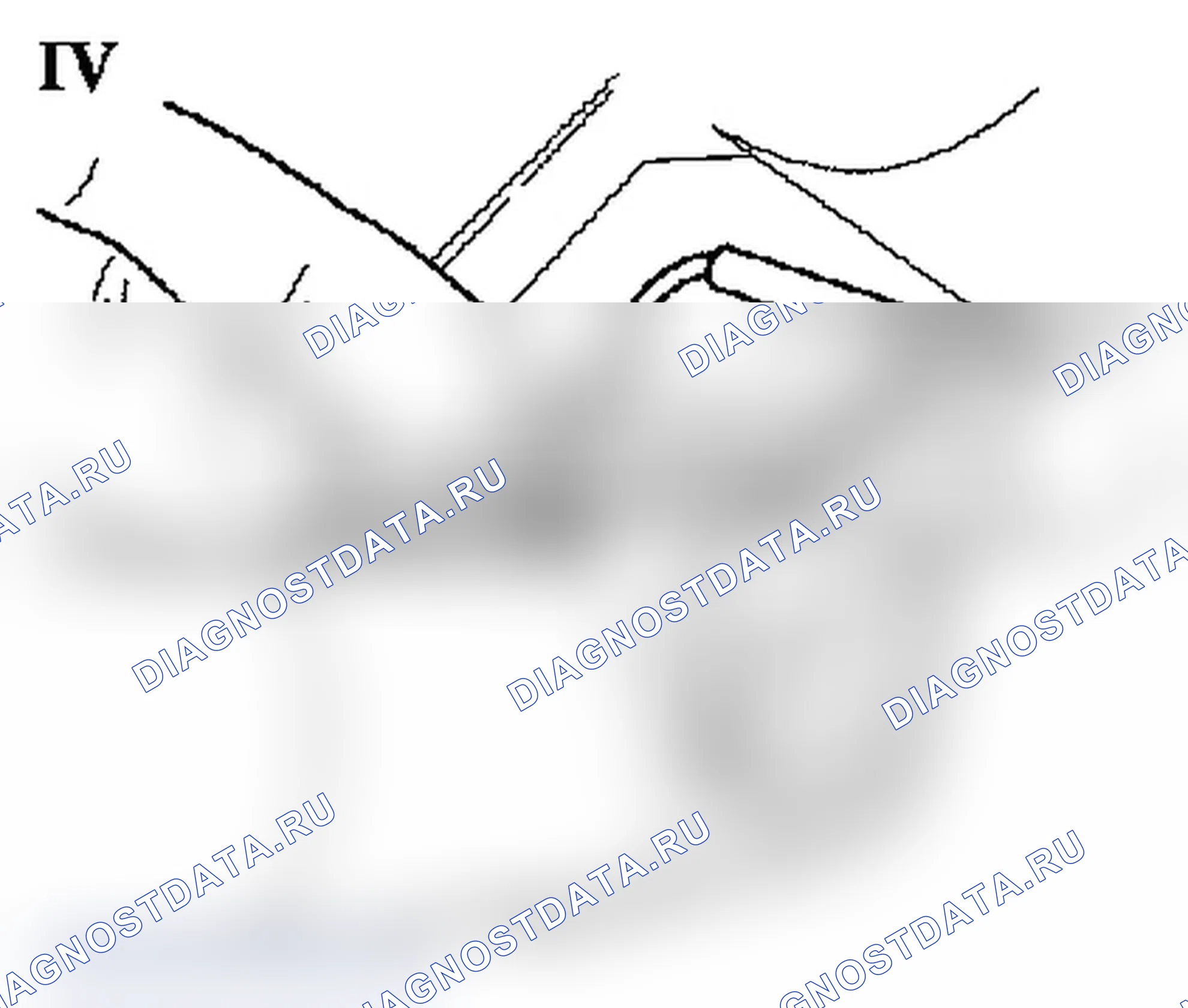 Coolant Temperature Sensor - Wiring harness connector poor contact. Opel Combo C