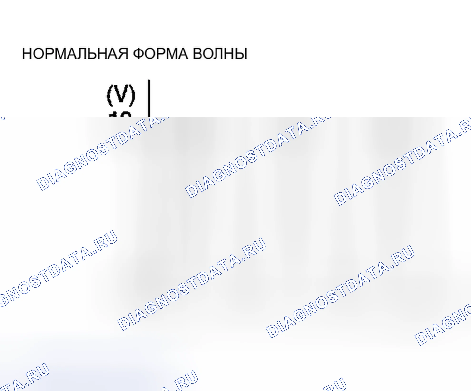 Рис. 13. Mitsubishi Eclipse III
