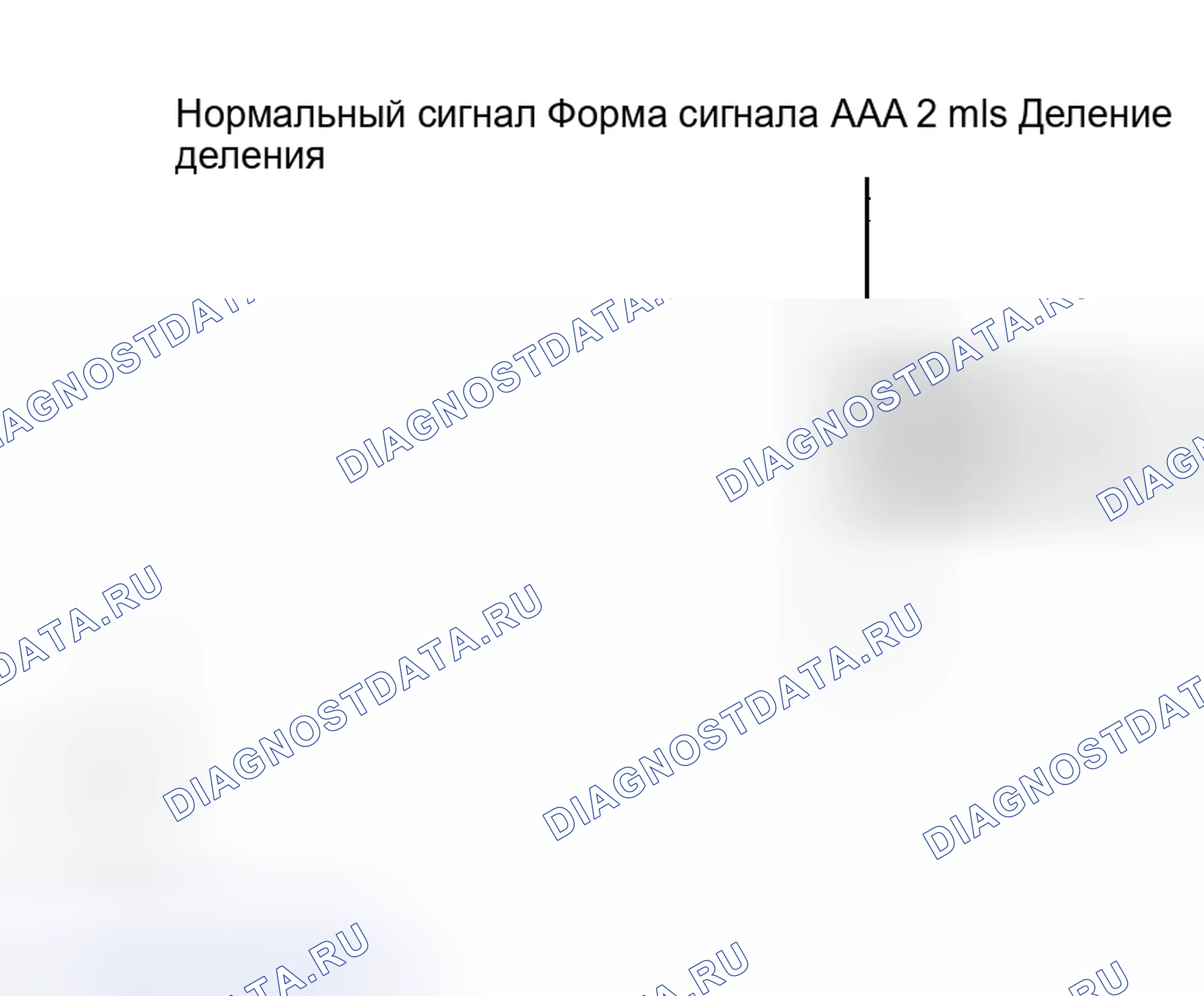 Рис. 27: ПРОЦЕДУРА КОНТРОЛЯ. Toyota Matrix E130