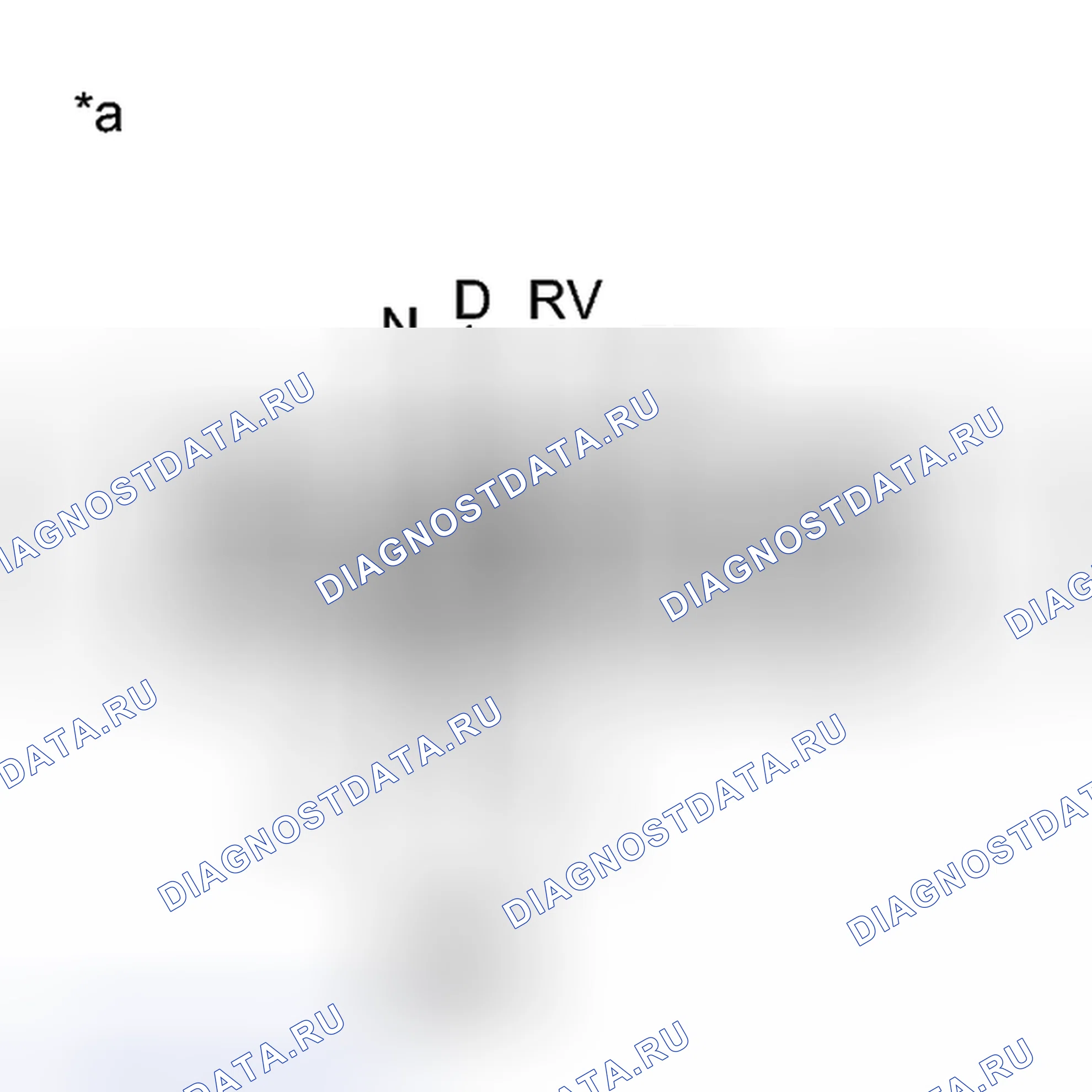 Рис. 249: ПОРЯДОК ВЫПОЛНЕНИЯ РАБОТ. Toyota Camry XV50