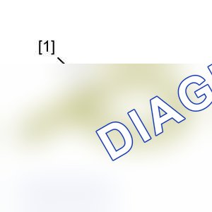 Демонтаж: двигателя — e5ap1dbc. Citroen C3 I