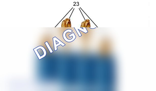 Демонтаж: двигателя — b1dp1v2d. Citroen C3 I