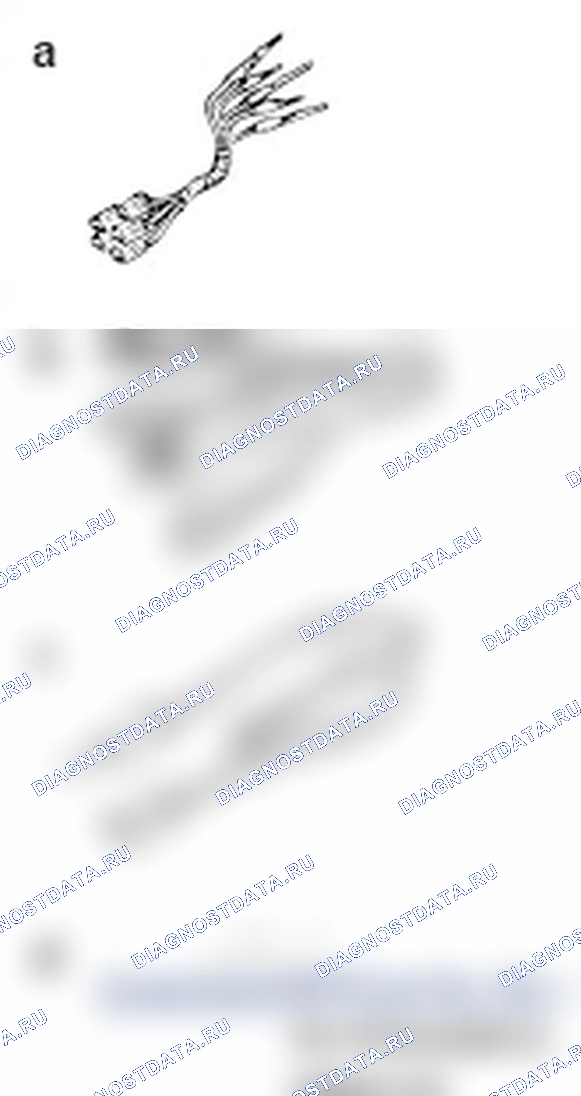 Рис. 95. Mitsubishi Lancer Ralliart X рестайлинг