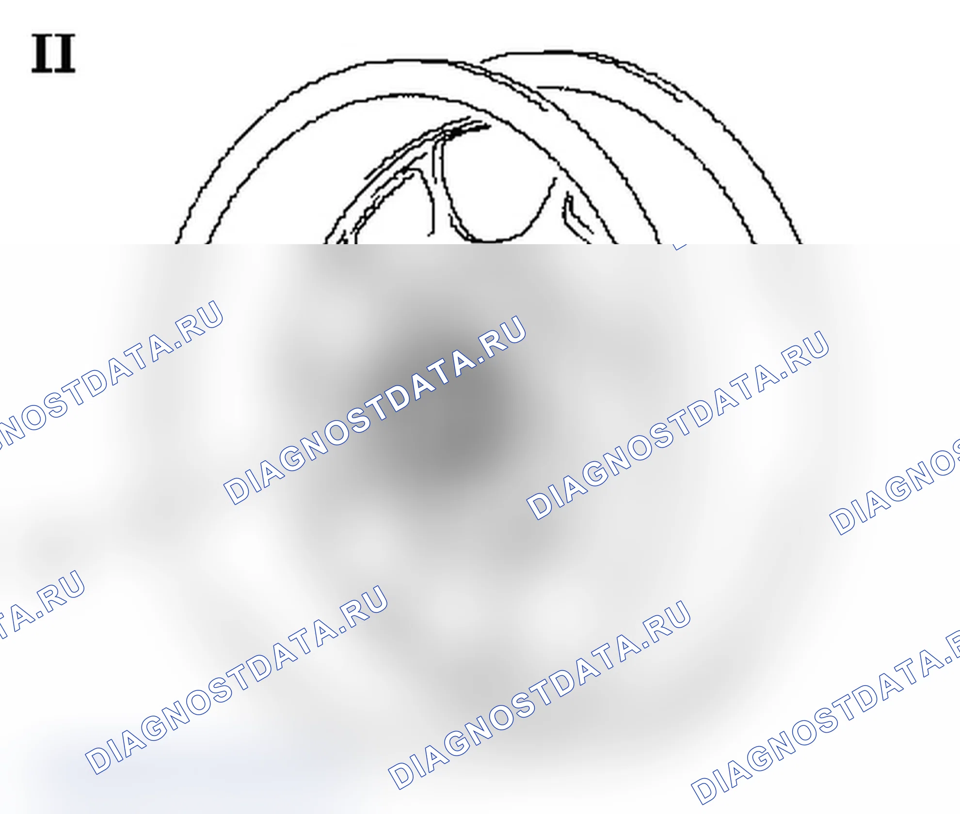 Alloy rim 'Riviera Edition' - Vibration during driving. Opel Agila A рестайлинг