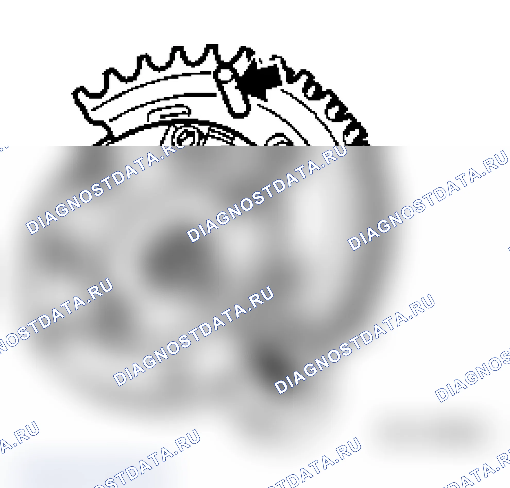 Рис. 626: Установка:. BMW M3 E36