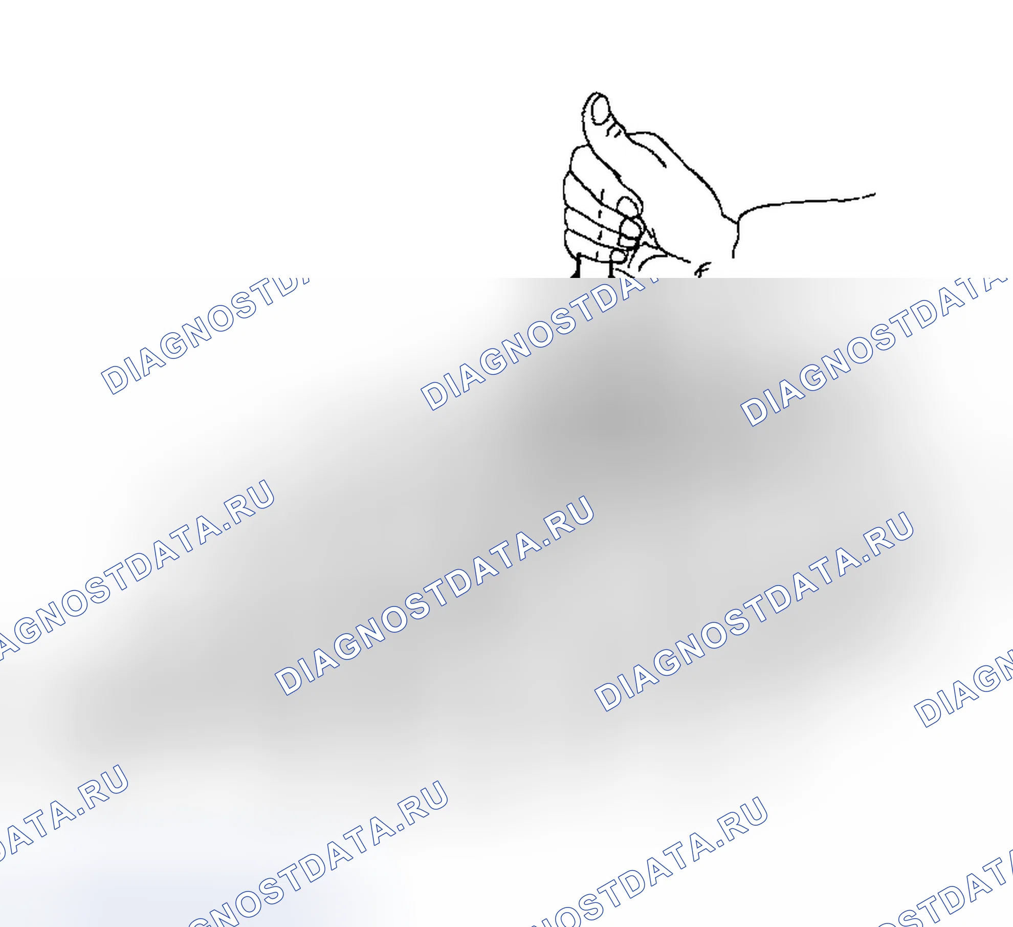 Рис. 143: КРЫШКИ ПОДШИПНИКОВ. Hyundai Tiburon II