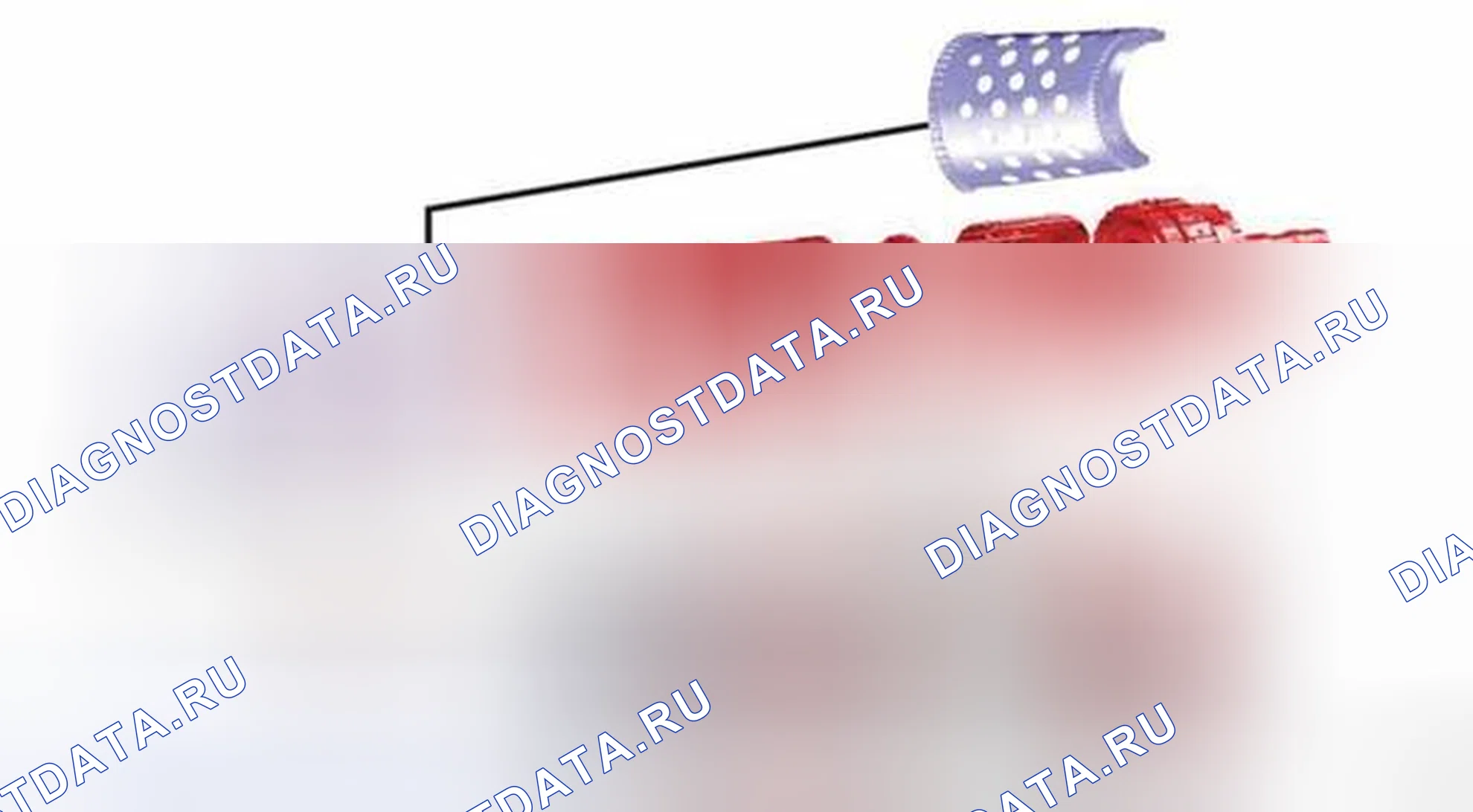 Рис. 215. RAM 1500 IV