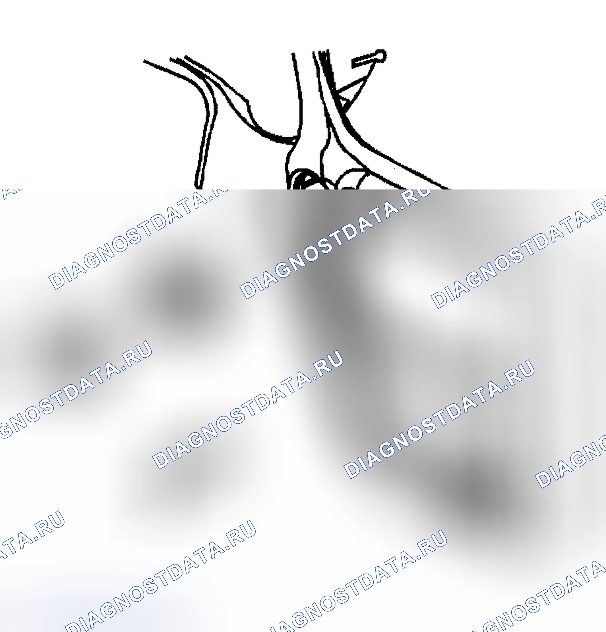 Рис. 421: Процедура установки. Chevrolet TrailBlazer I