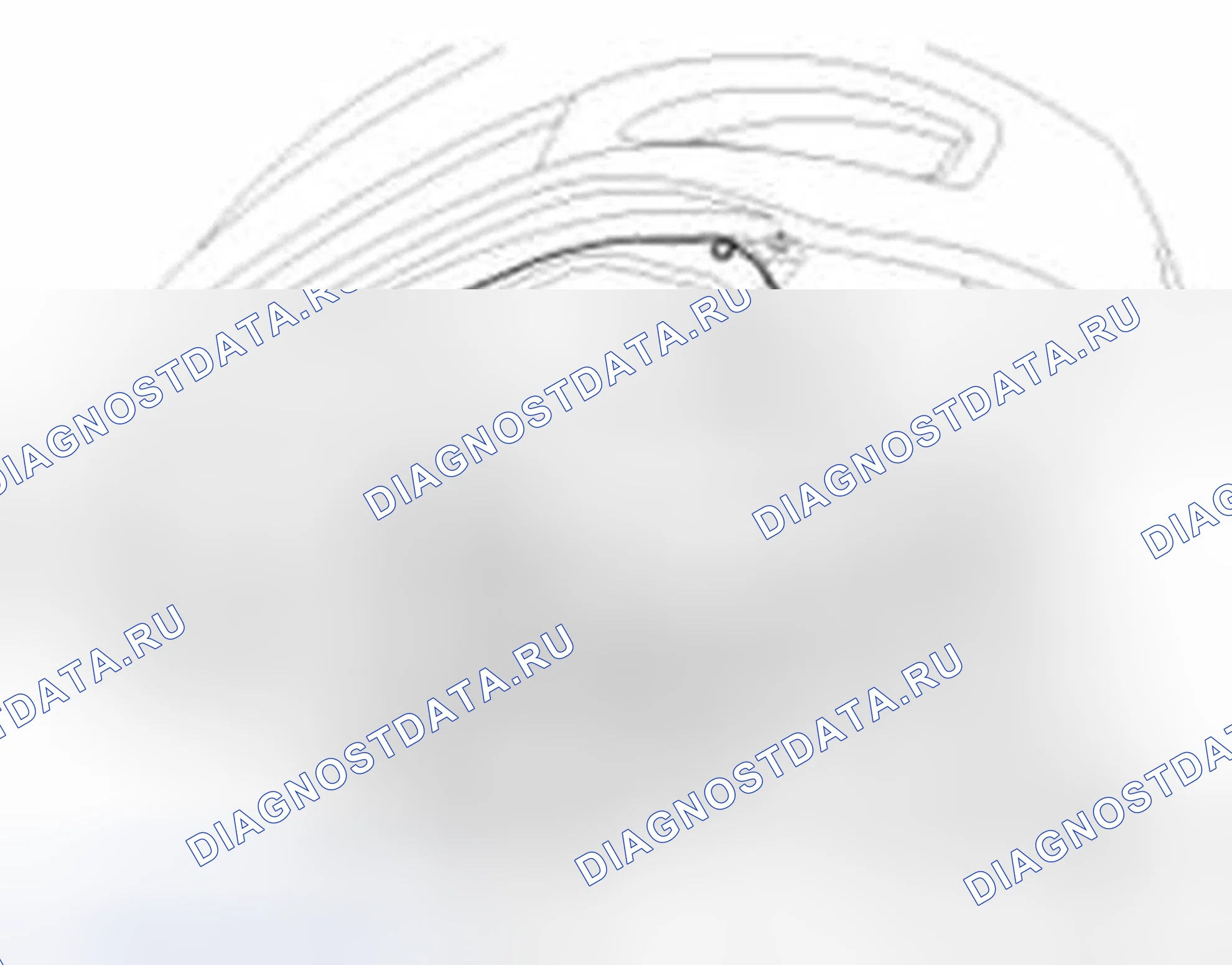 Рис. 133: Удаление. Hyundai Sonata VI