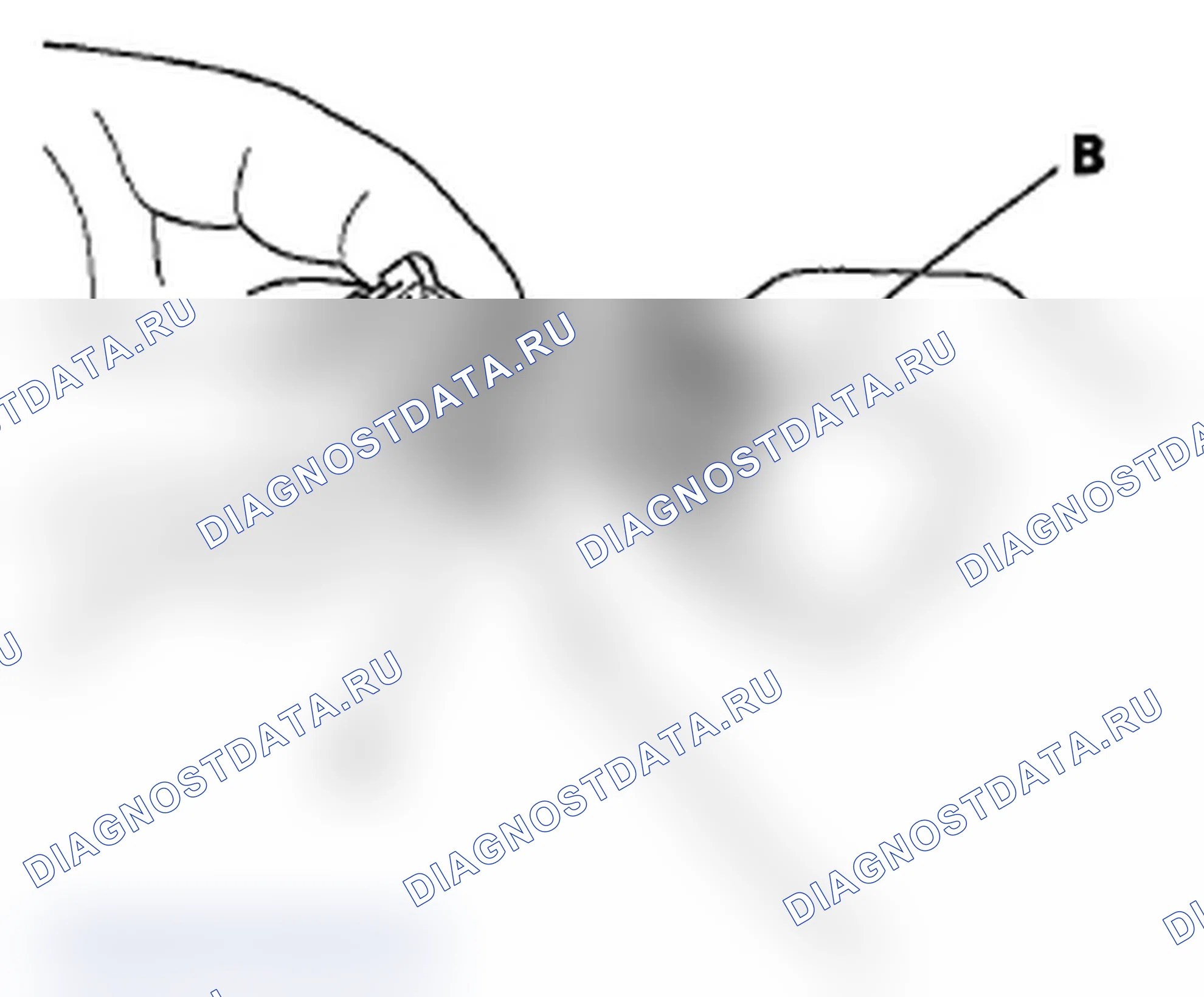 Рис. 21: Разъединение. Acura TL IV
